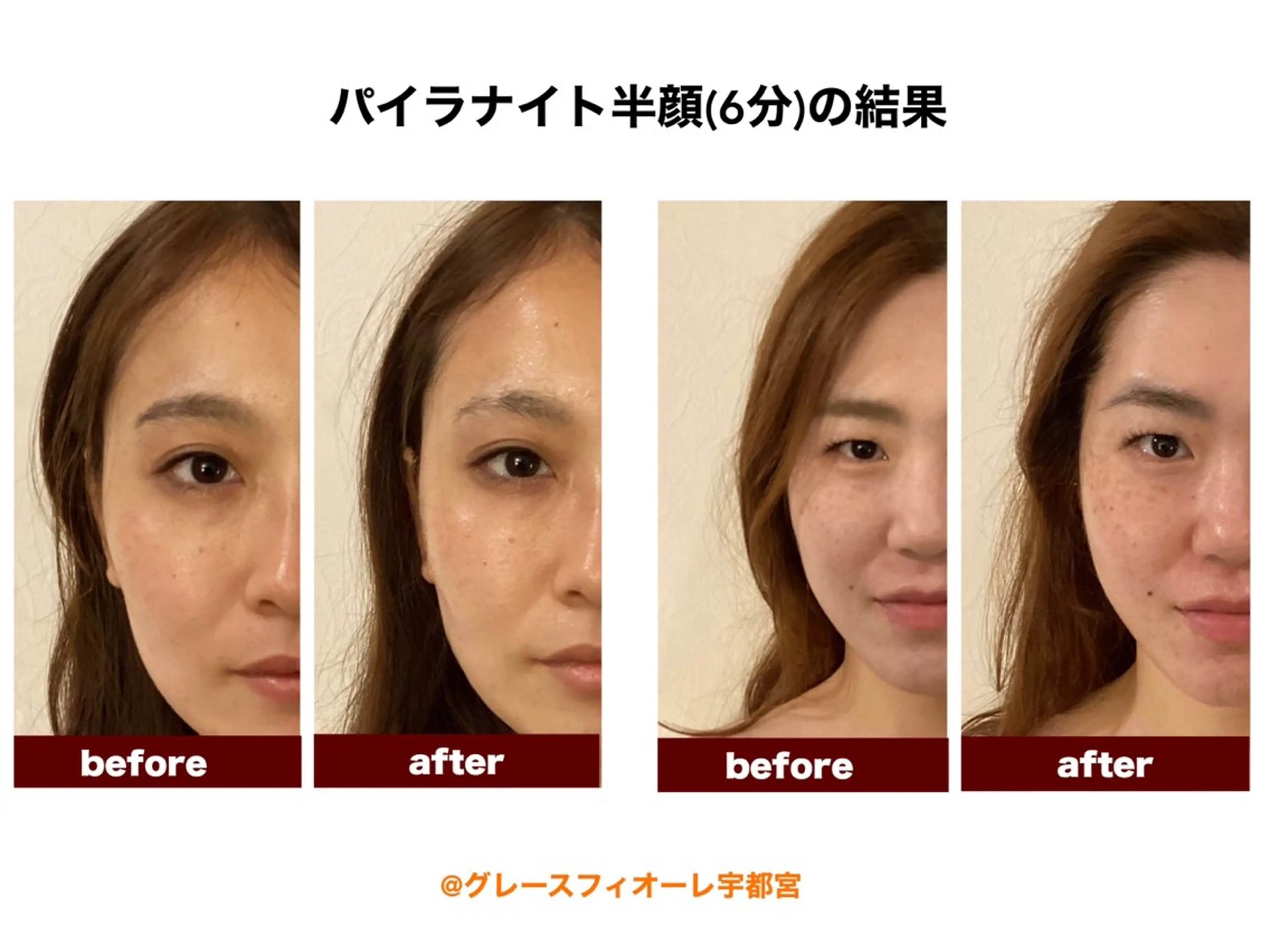 【Agrea】 RISAのエステ・リラクイメージ