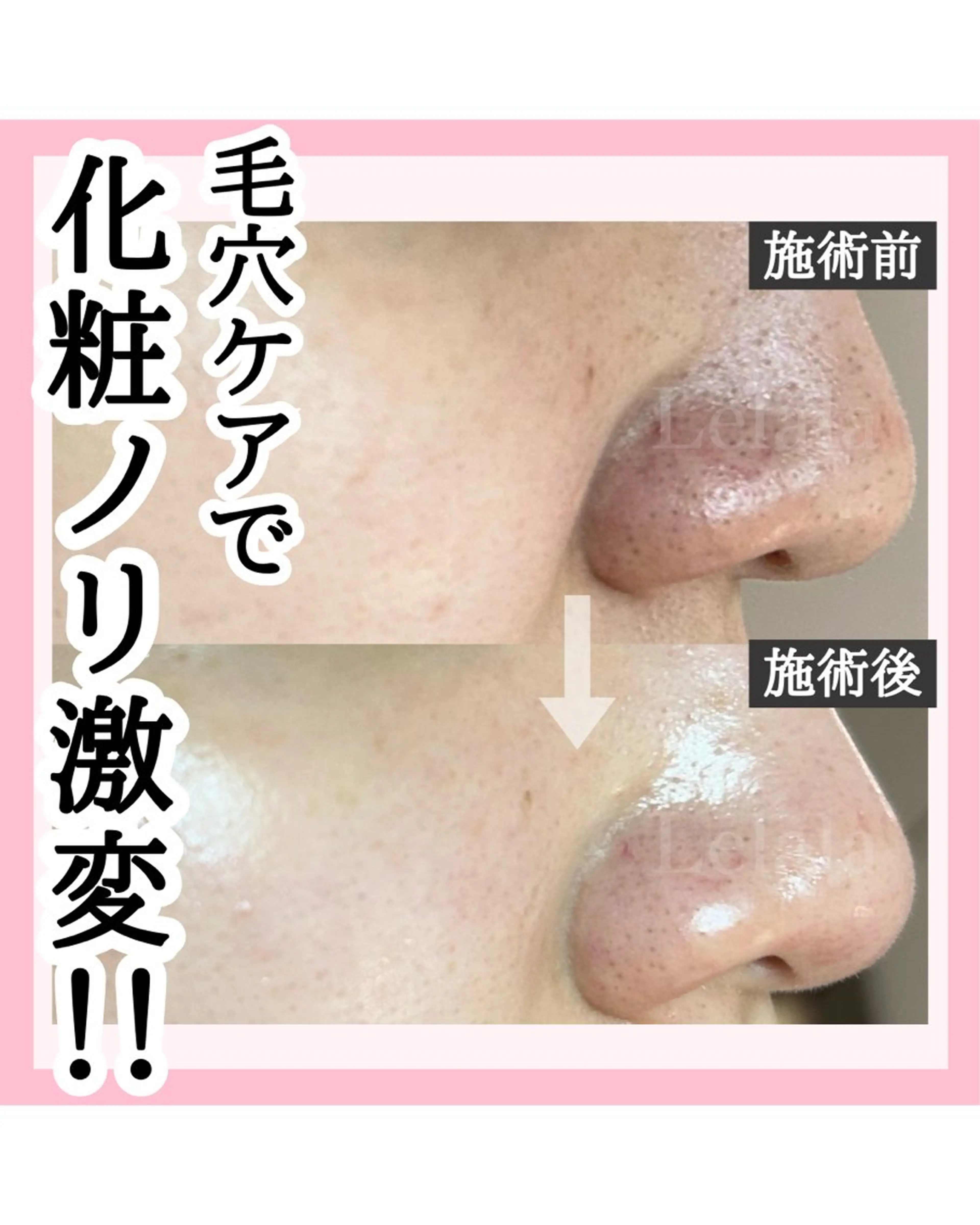 エステ リラク Salon Lelalaのエステ・リラクイメージ