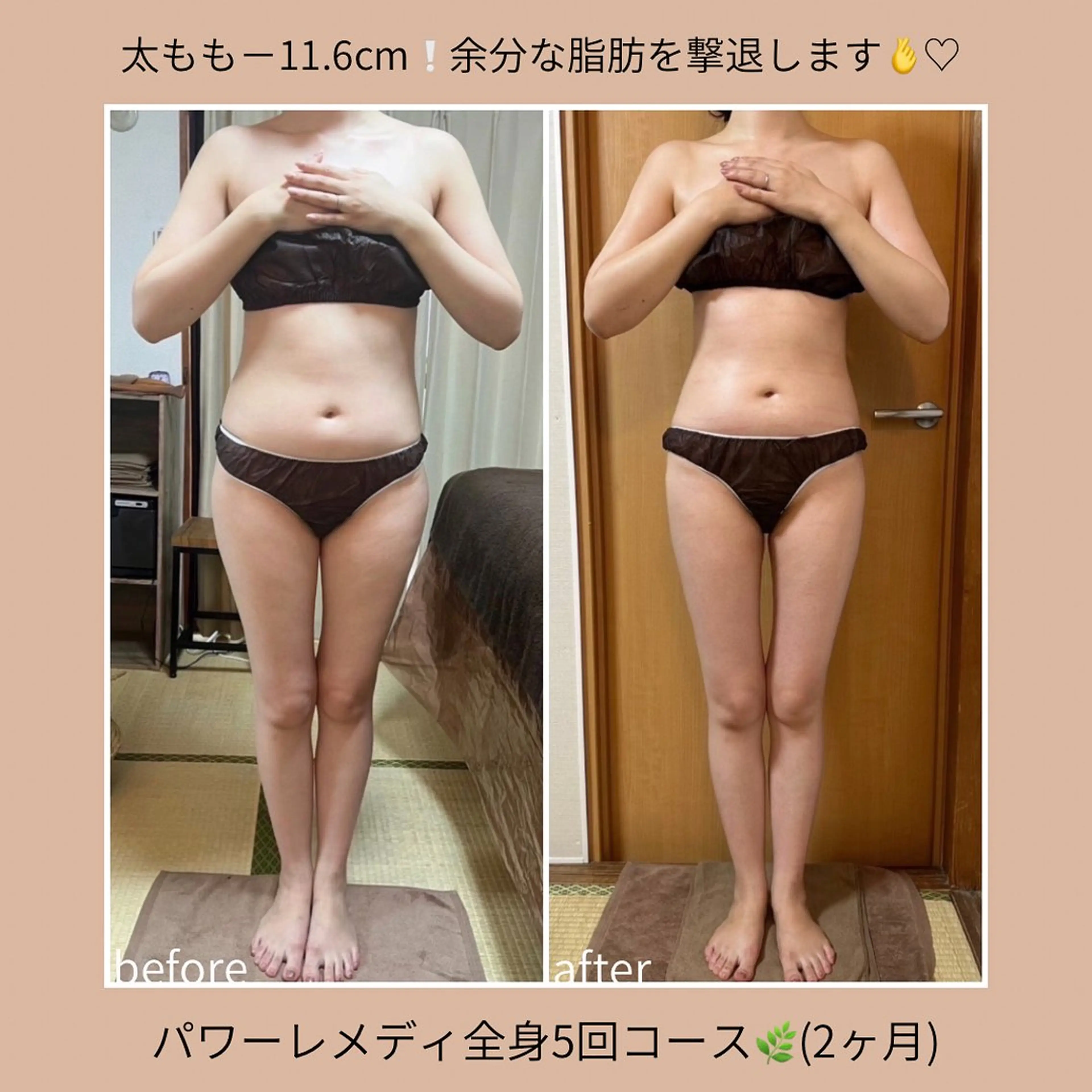 《本気痩せ×疲労改善 》  BILOOPのエステ・リラクイメージ
