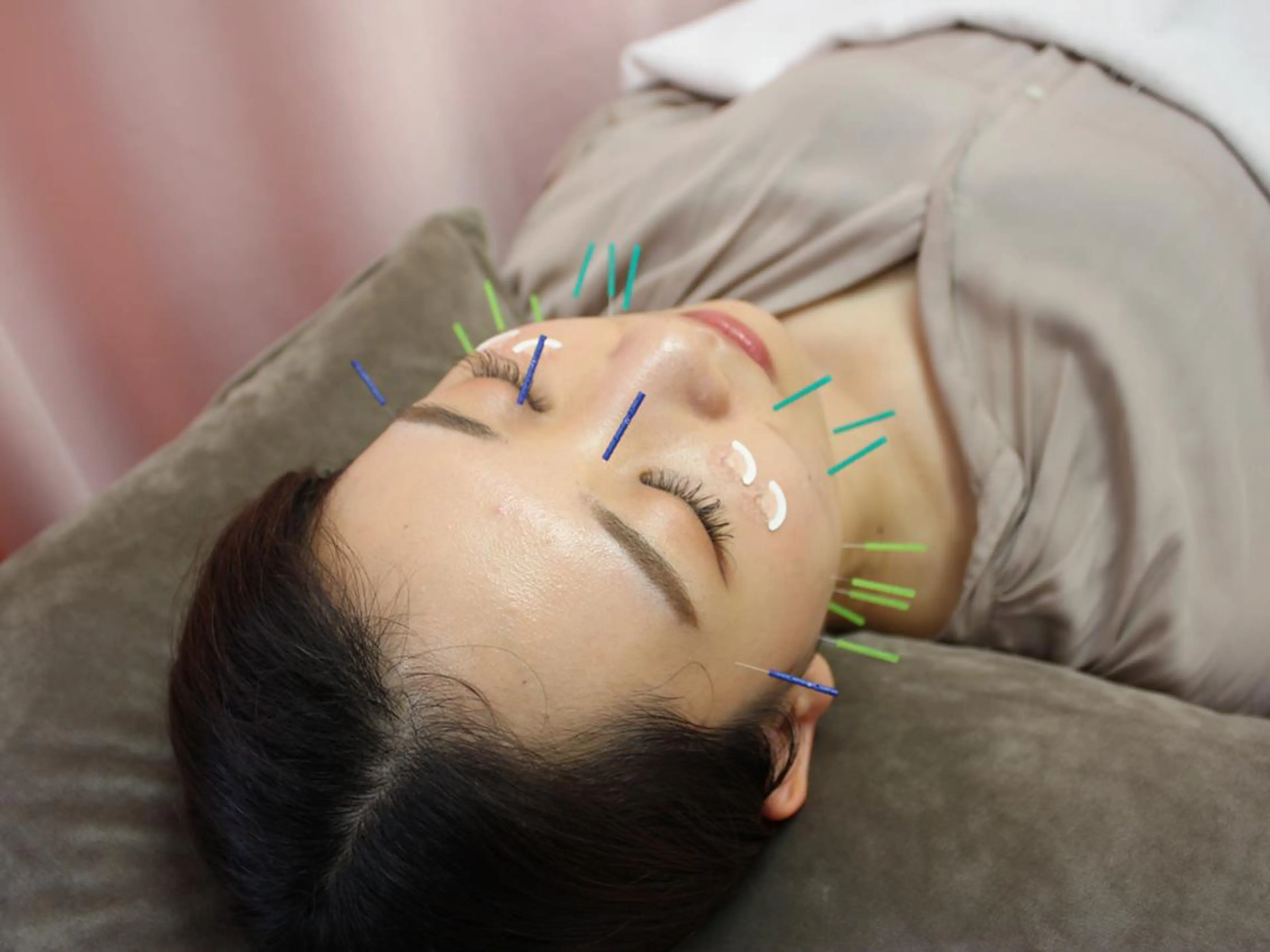 エステ リラク 同心整骨院 美容鍼・整体・小顔のエステ・リラクイメージ