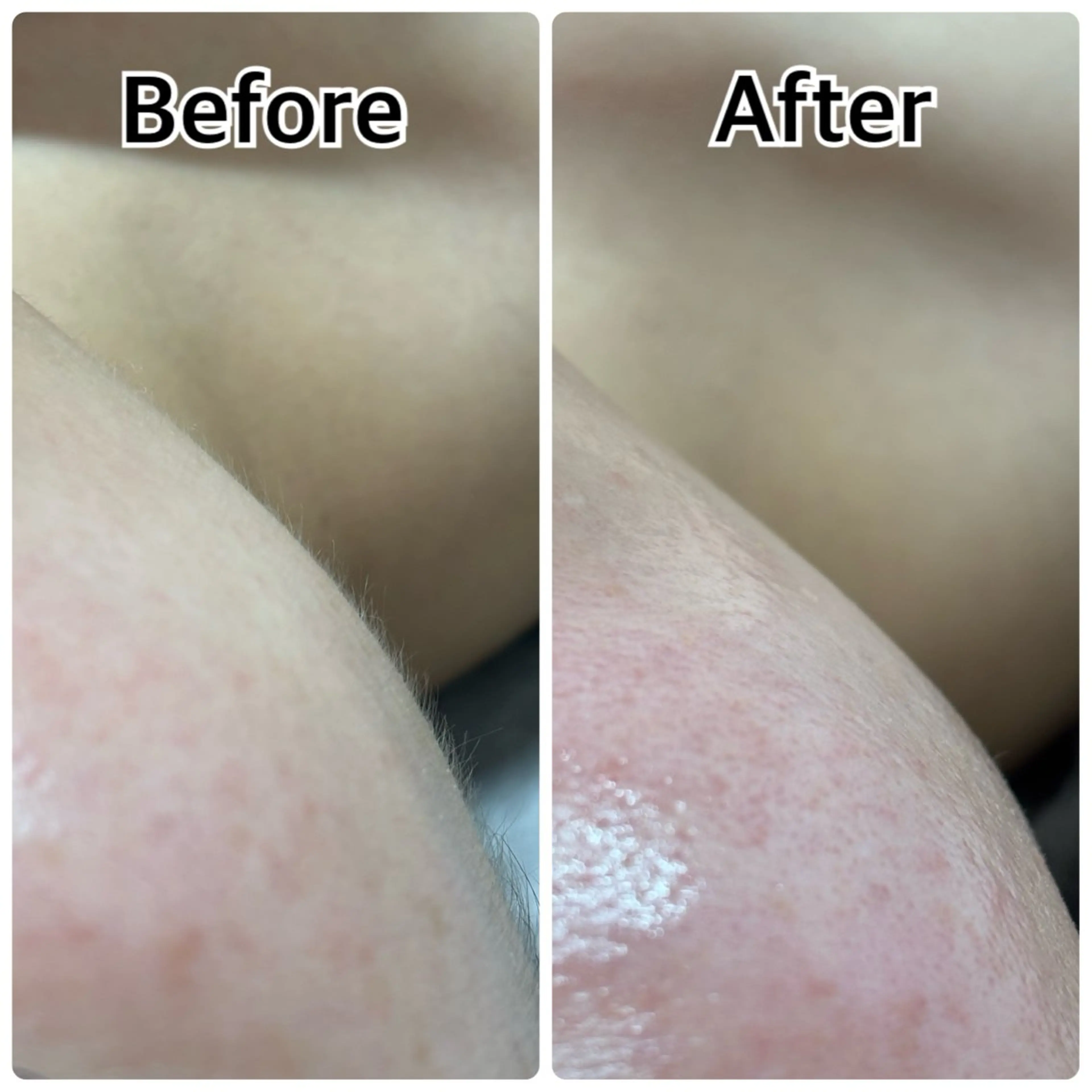 林 陽向のエステ・リラクイメージ