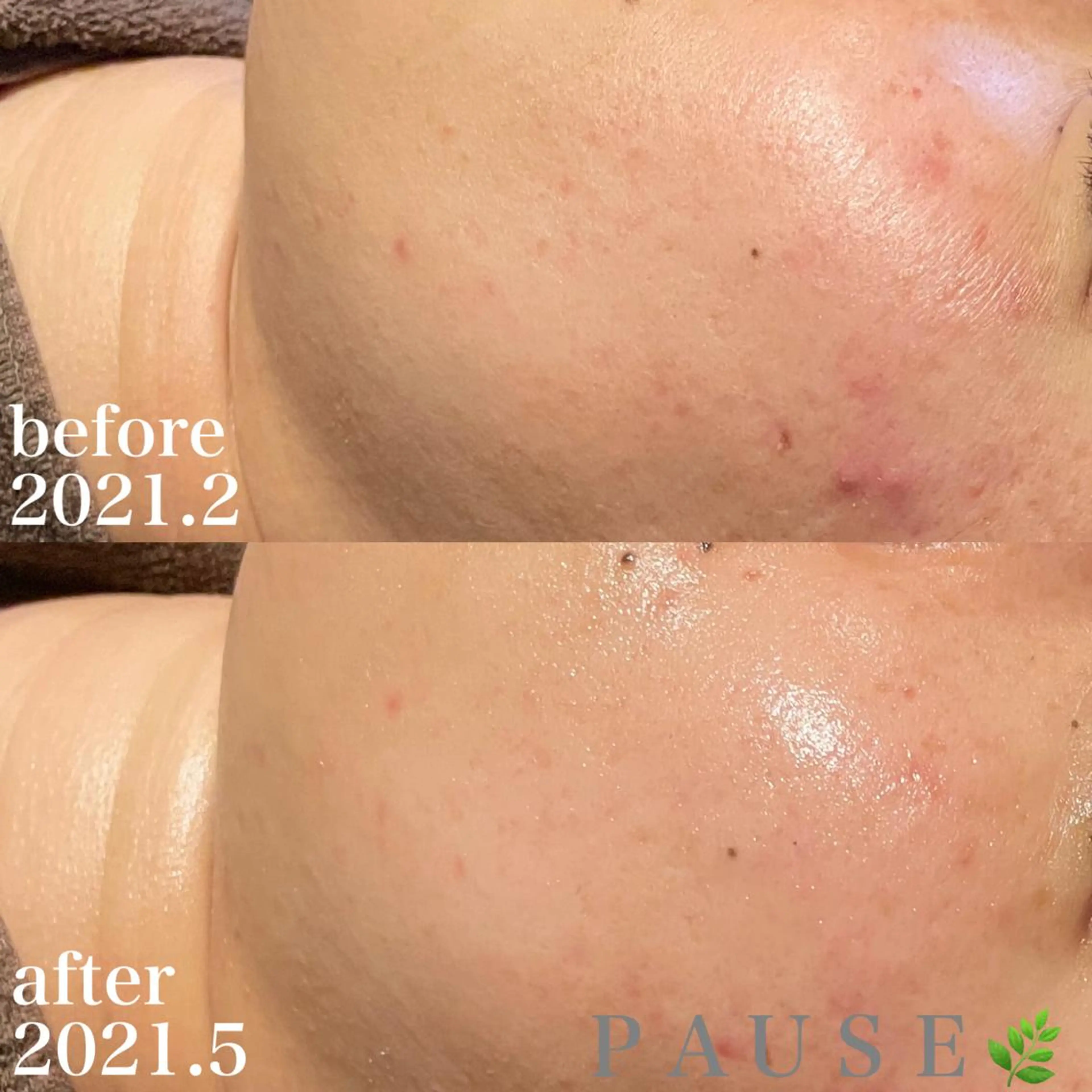 エステ 浜野 恵美のエステ・リラクイメージ