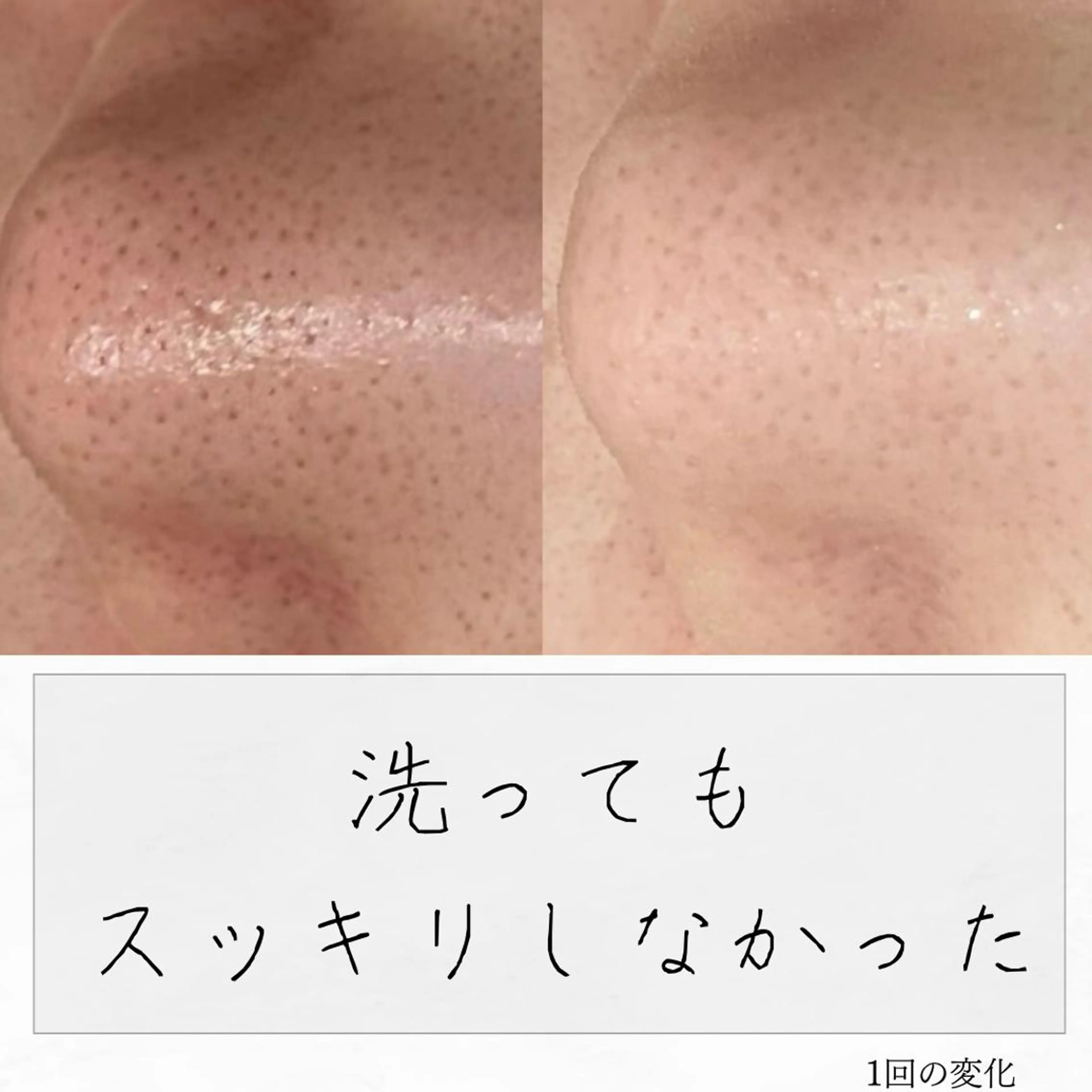 ニキビ経験者が施術 する専門サロン🌻のエステ・リラクイメージ