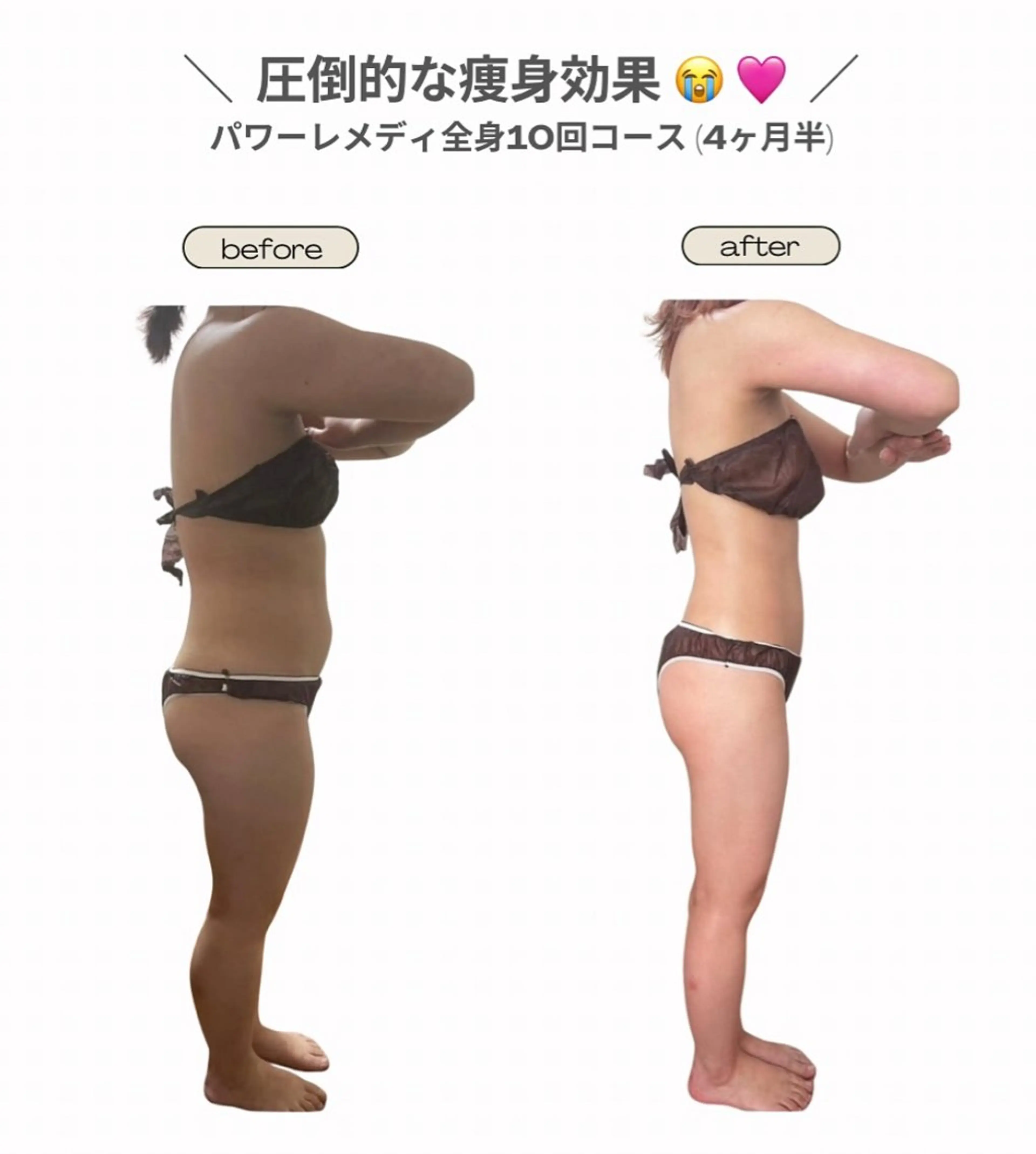 エステ リラク biloop所属・《本気痩せ×疲労改善 》  BILOOPのエステ・リラクイメージ