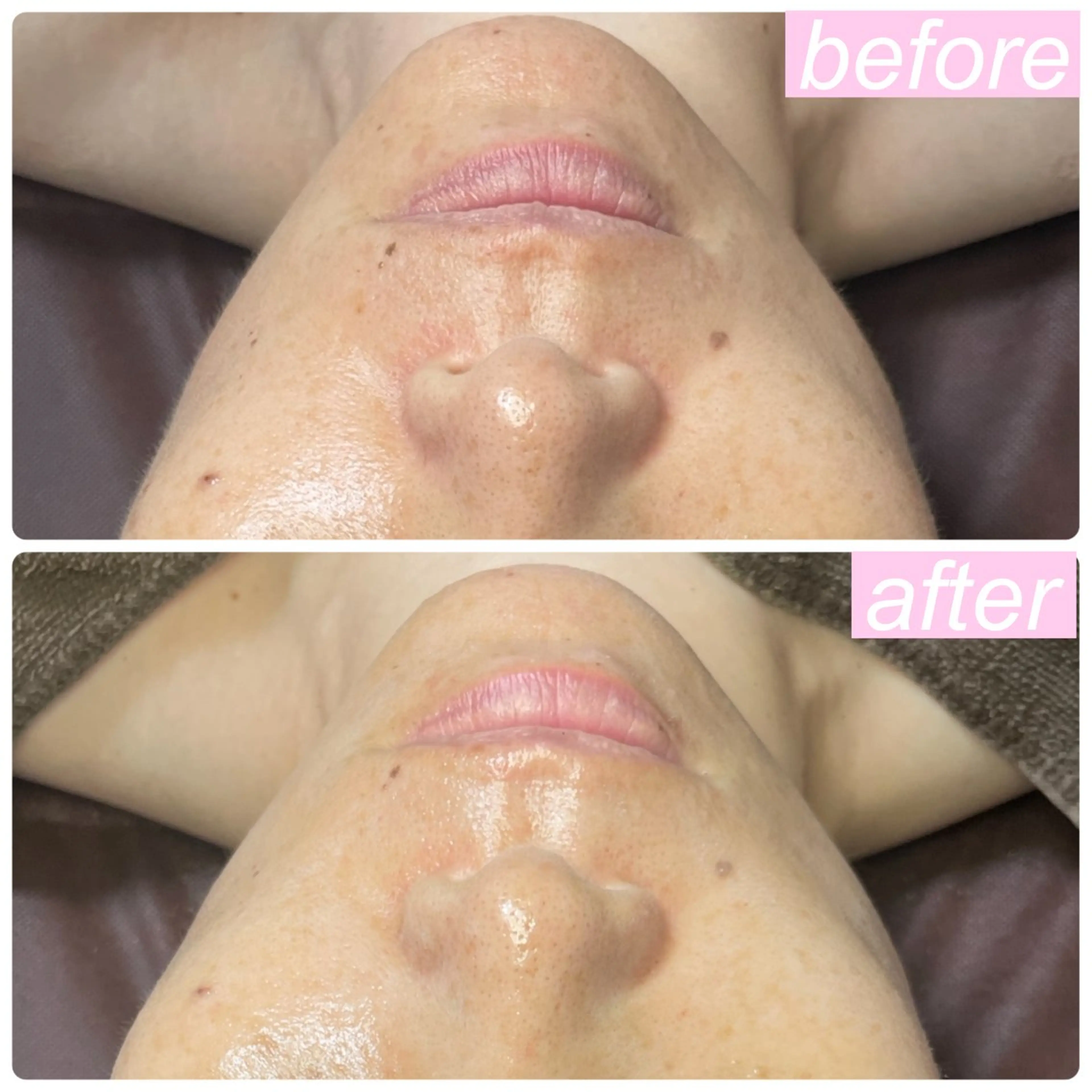 エステ 肌育脱毛サロン LikoLinaのその他イメージ