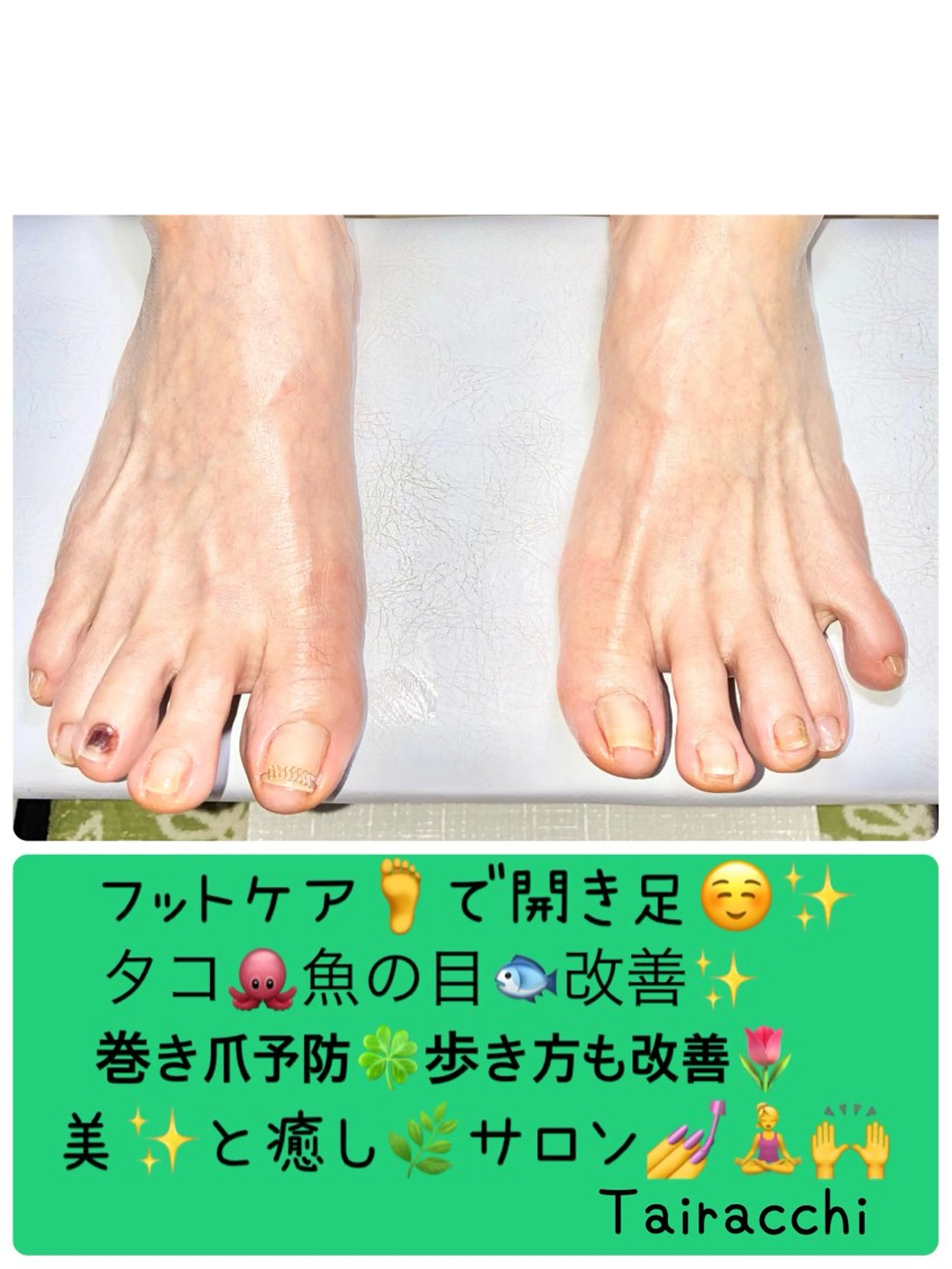 ネイル フットネイル フットネイル Tairacchi タイラッチのネイルデザイン