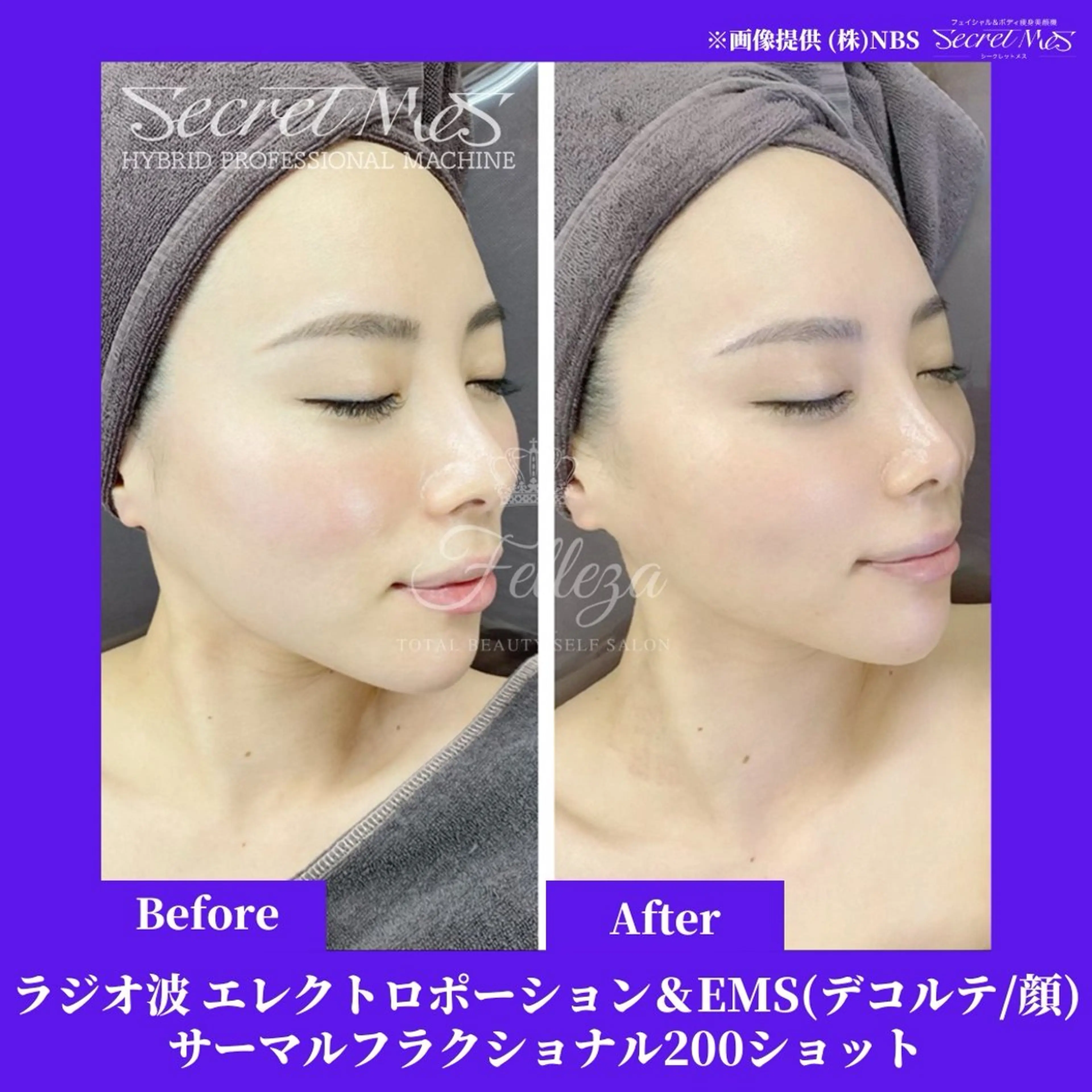 メンズ 有人型セルフサロン 脱毛／痩身／美顔のエステ・リラクイメージ