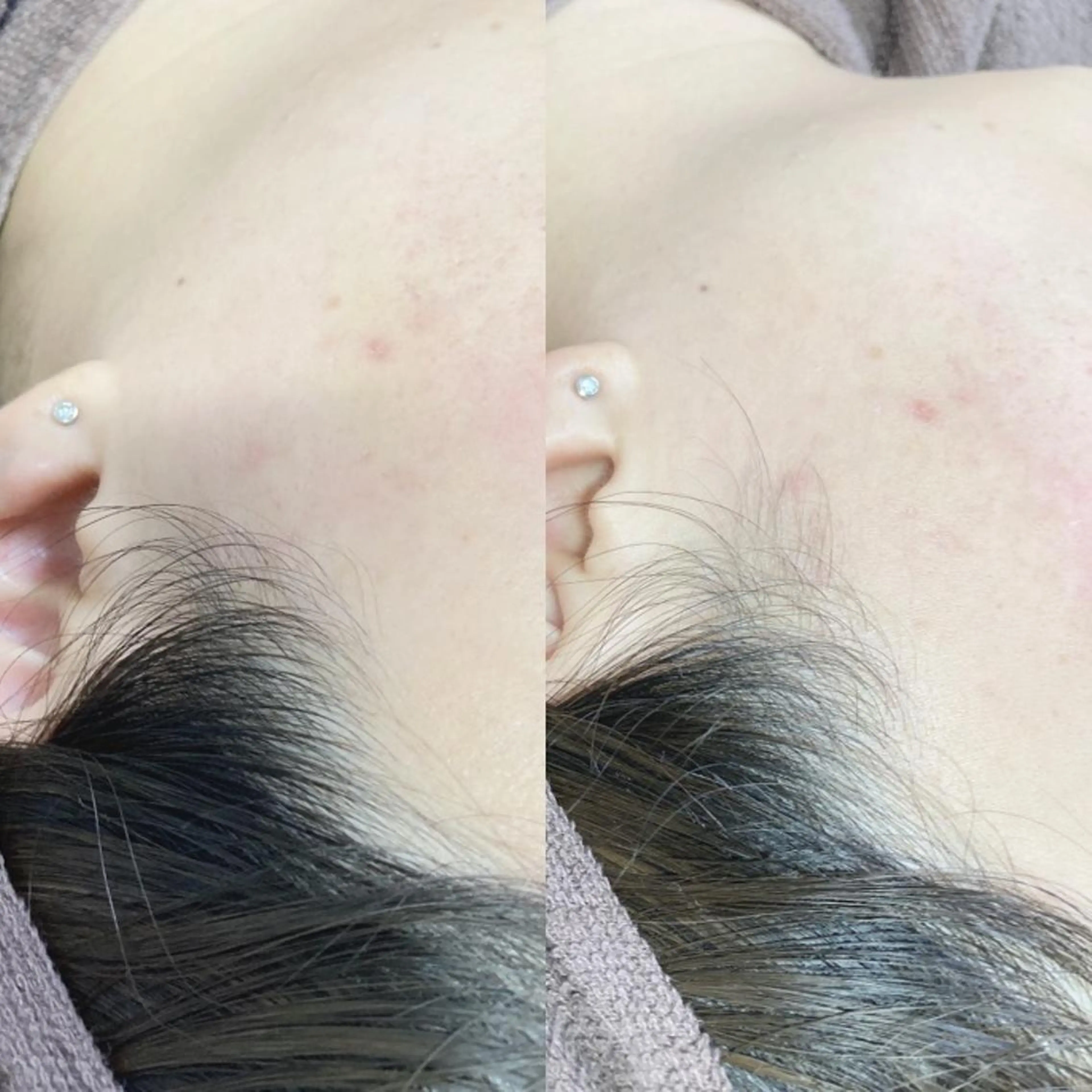 脱毛 産毛専門店 Bittoのエステ・リラクイメージ