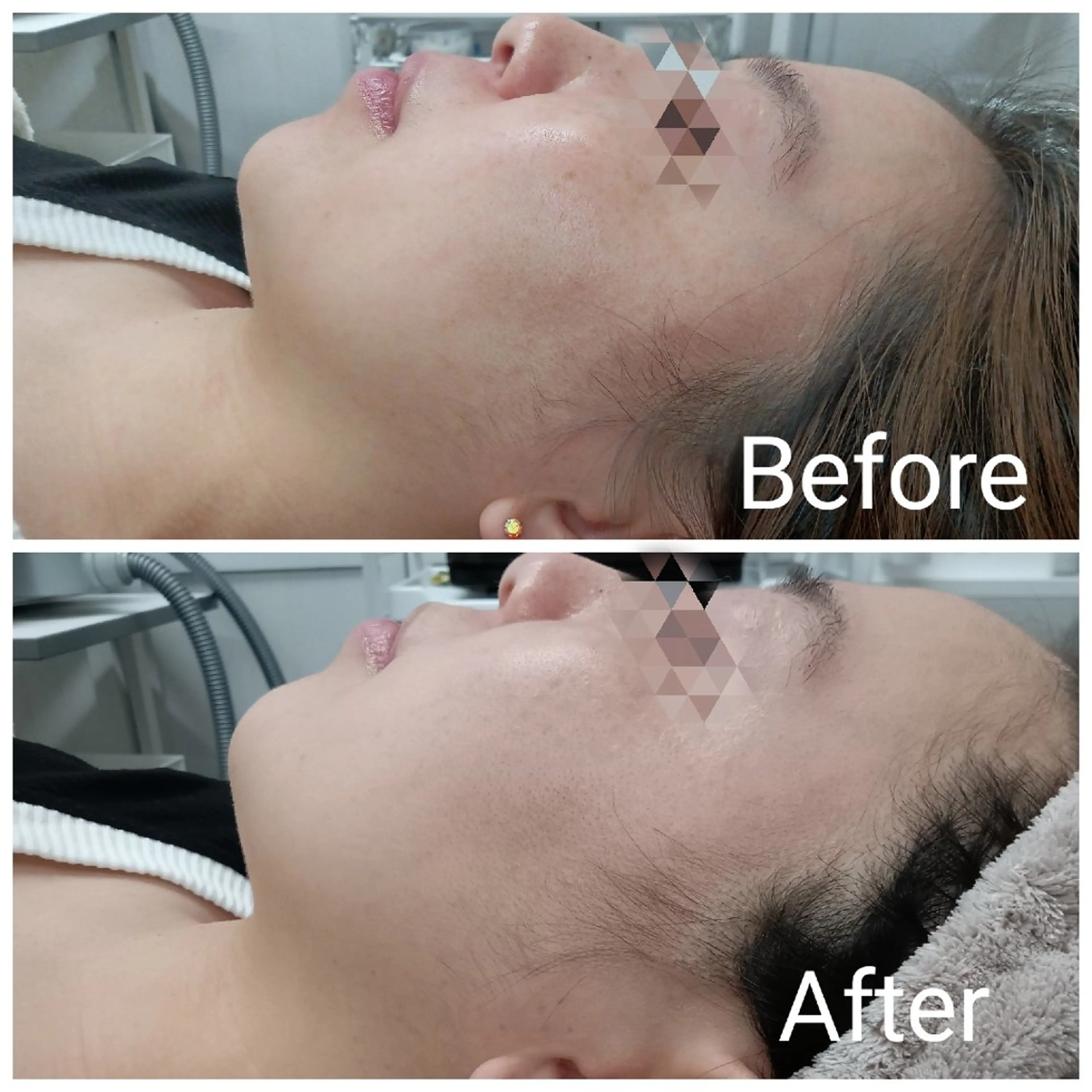 エステ 肌質改善Beauty salon Renのエステ・リラクイメージ