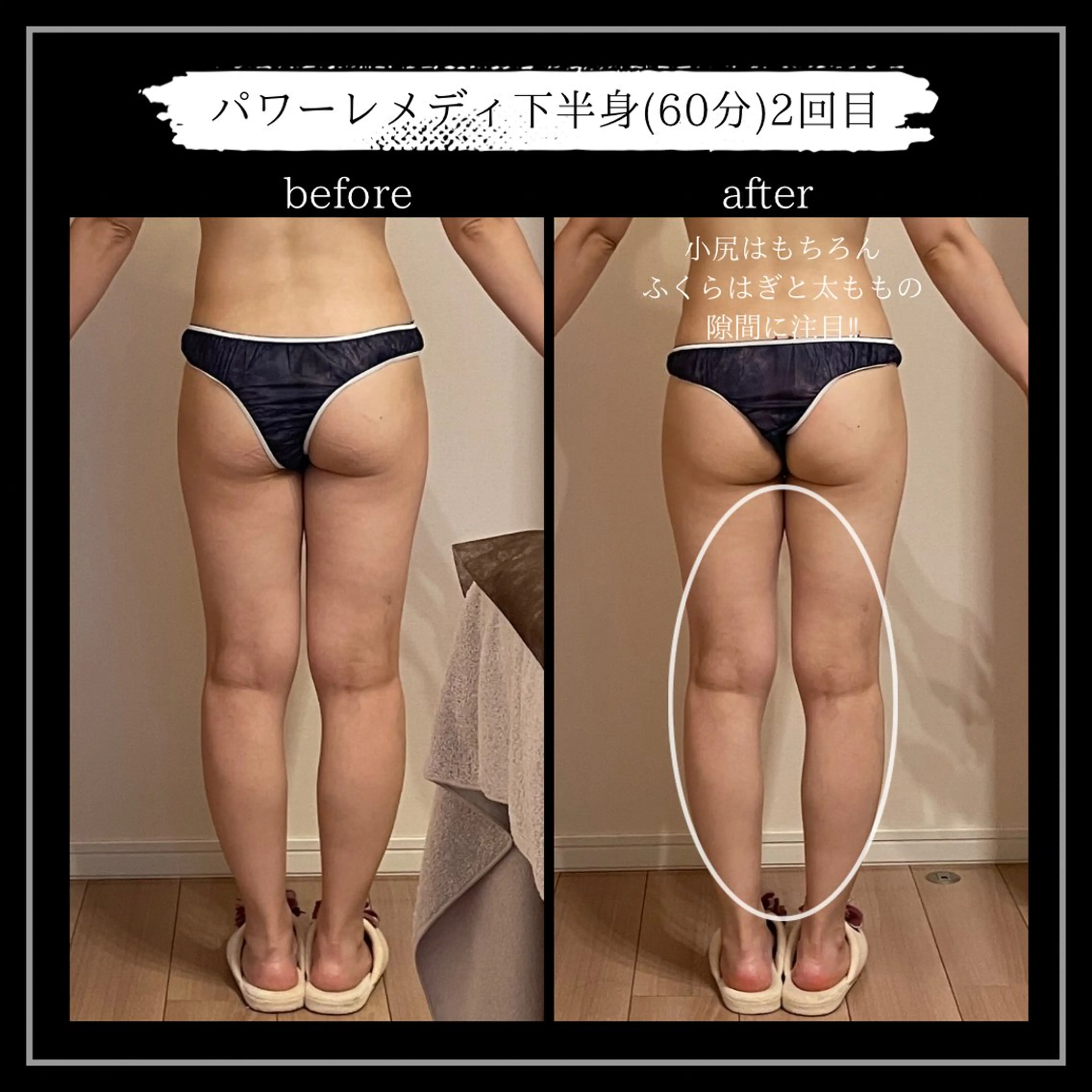 オフ:オン 全身筋膜マッサージのエステ・リラクイメージ