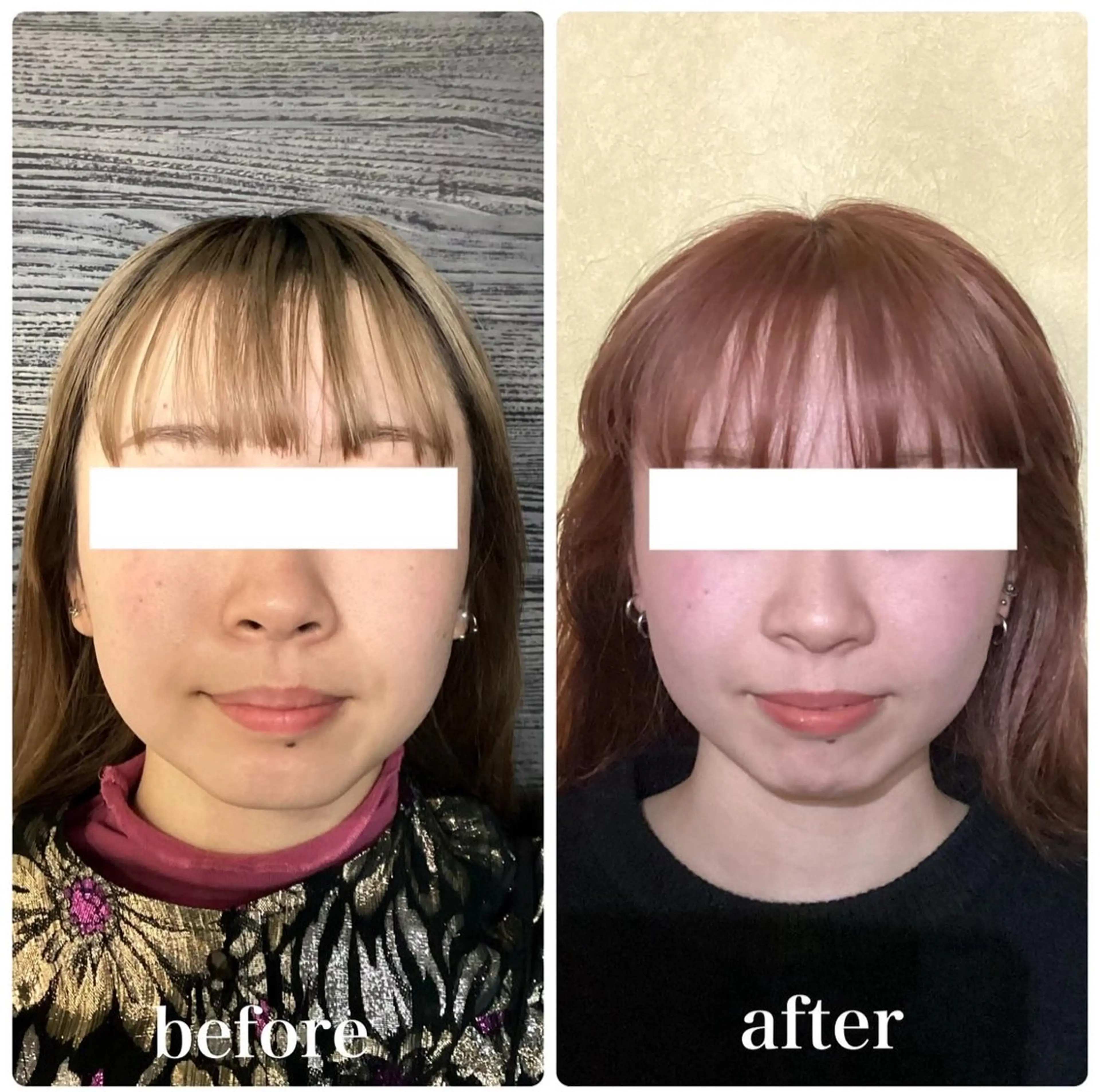 ルコナビューティ所属・小顔・歪み専門　井元 朋子のエステ・リラクイメージ