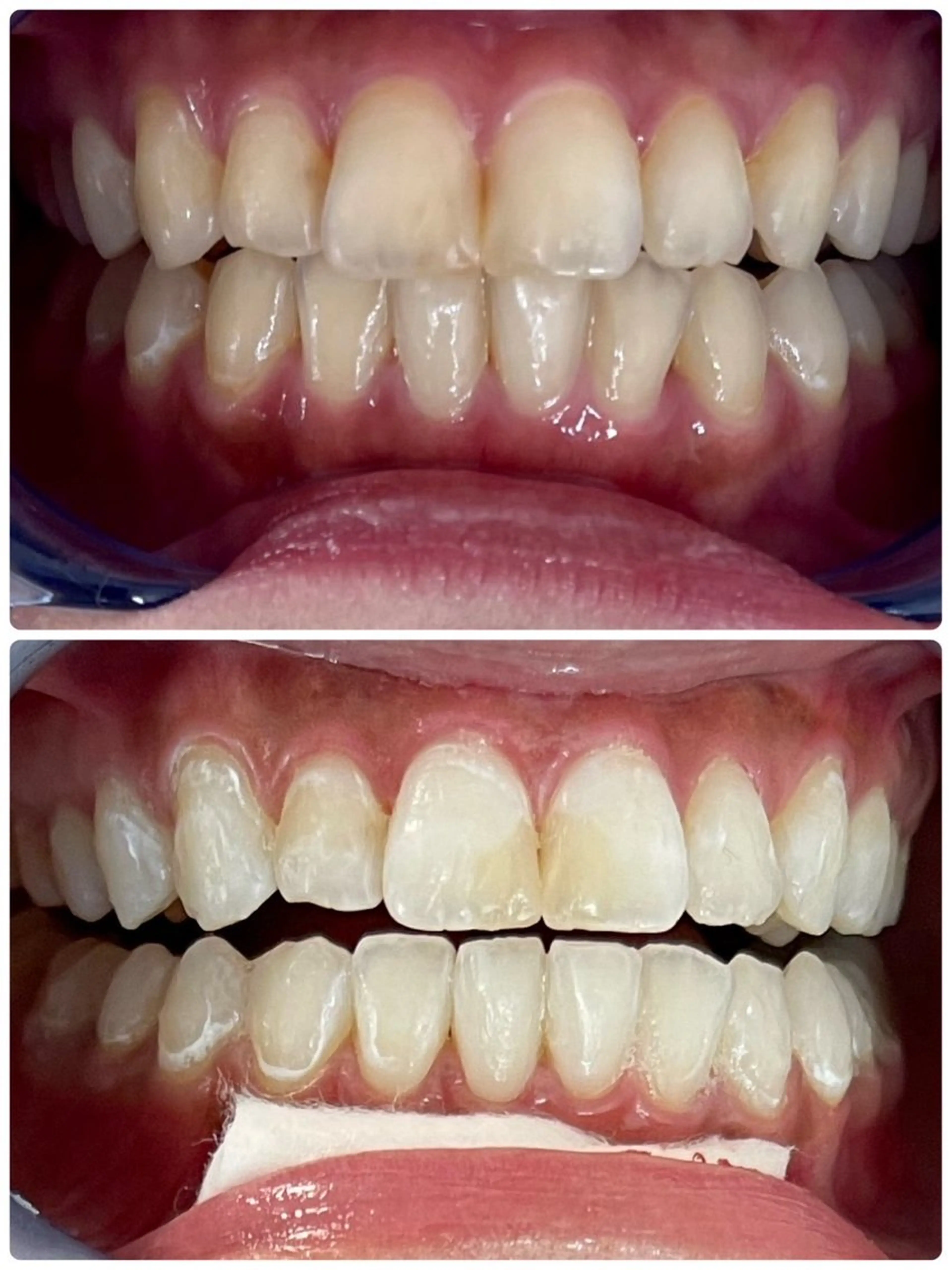 セルフホワイトニング エクシア徳島店マユのその他イメージ