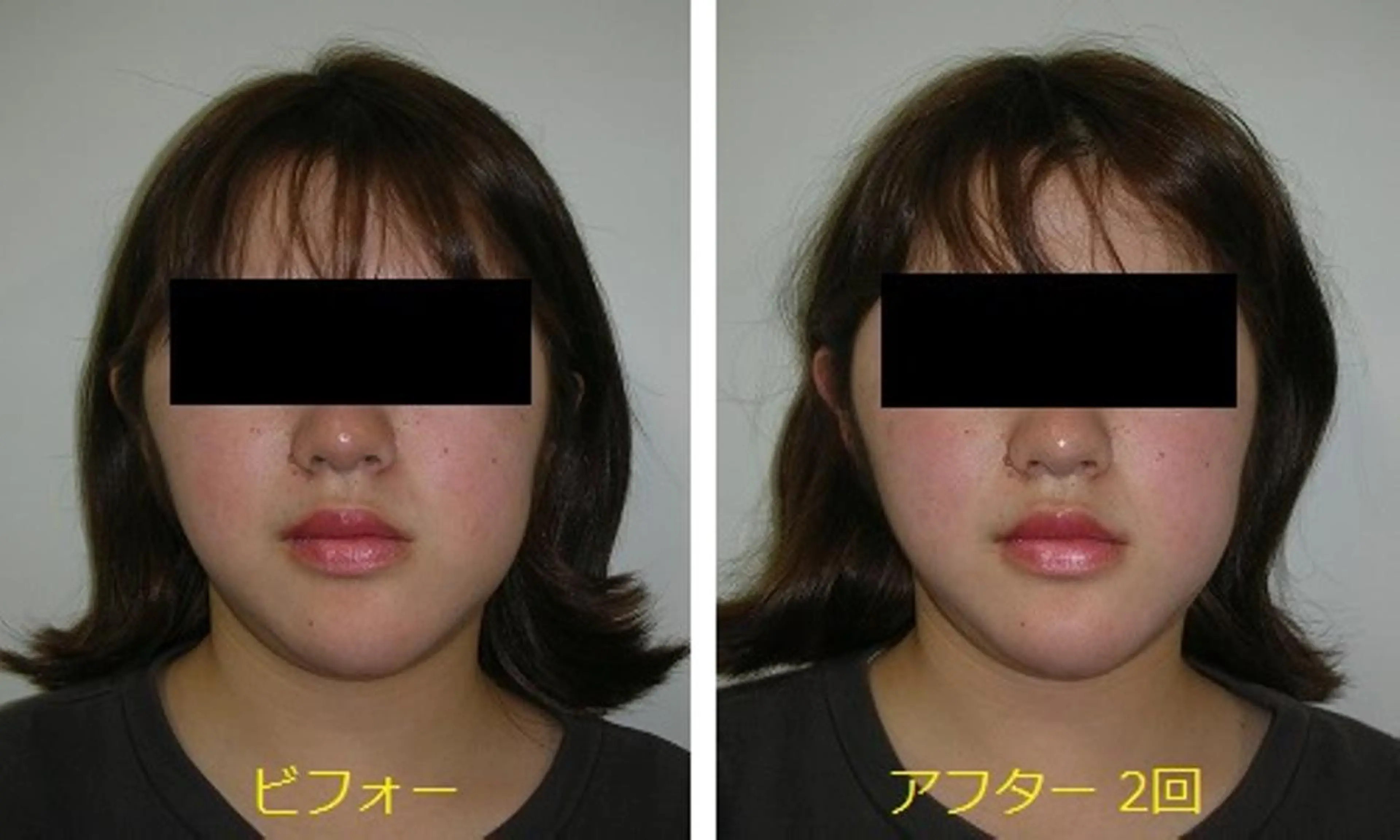 吉信 　のエステ・リラクイメージ