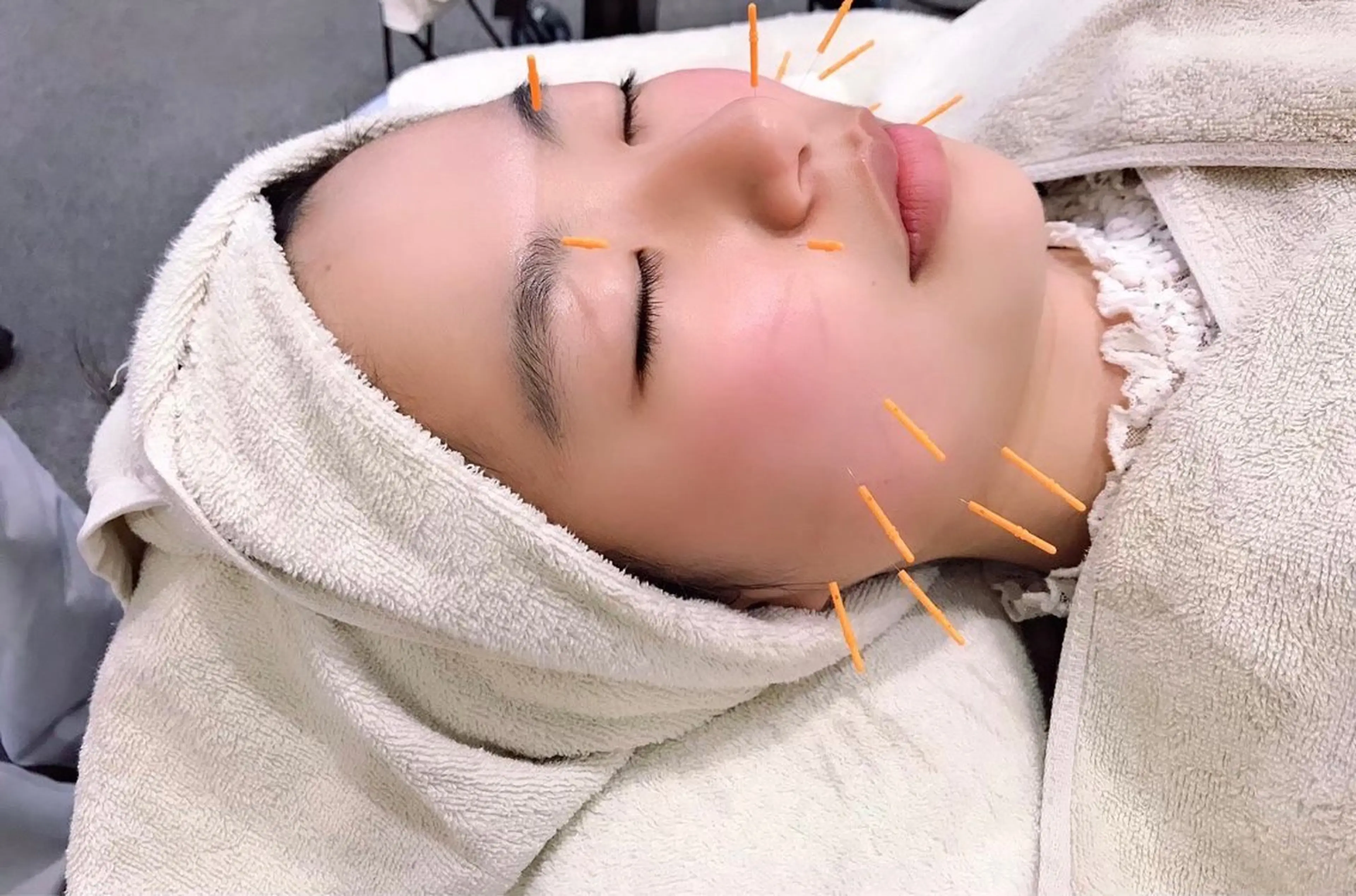 ヒロスポーツ 鍼灸整骨院のエステ・リラクイメージ