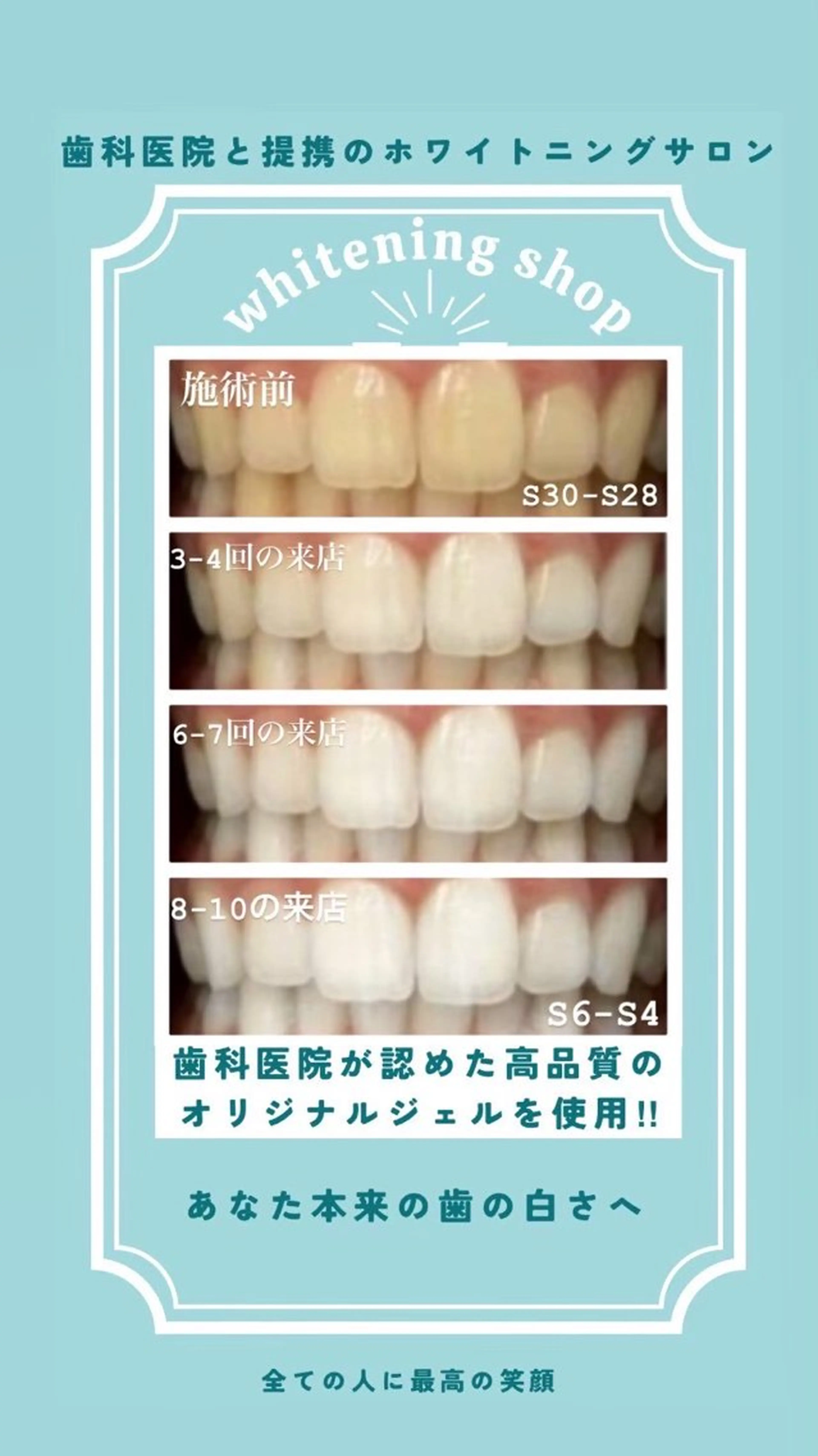 ホワイトニング ショップ伊丹店のその他イメージ