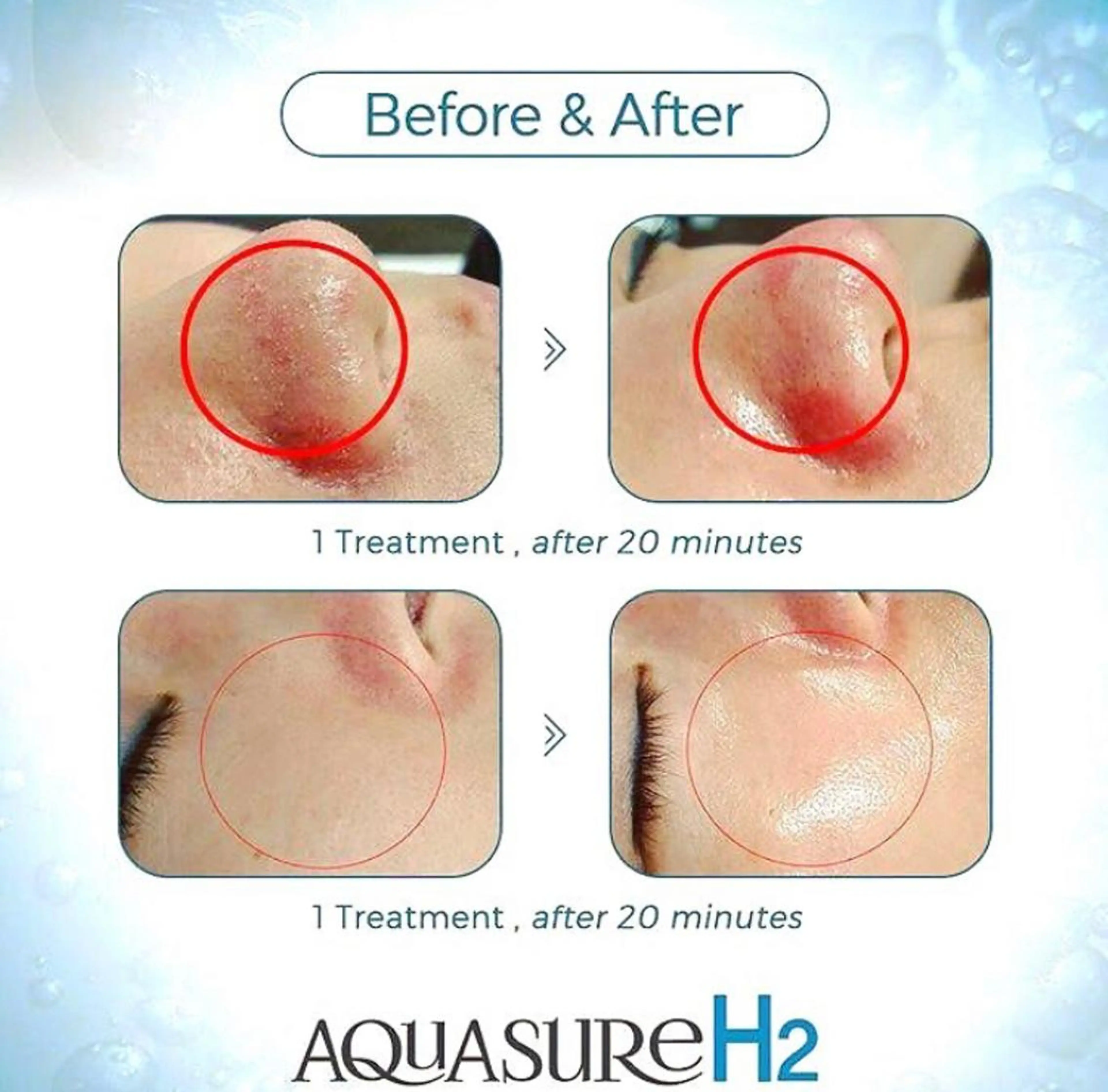 Lila プライベートサロンのエステ・リラクイメージ