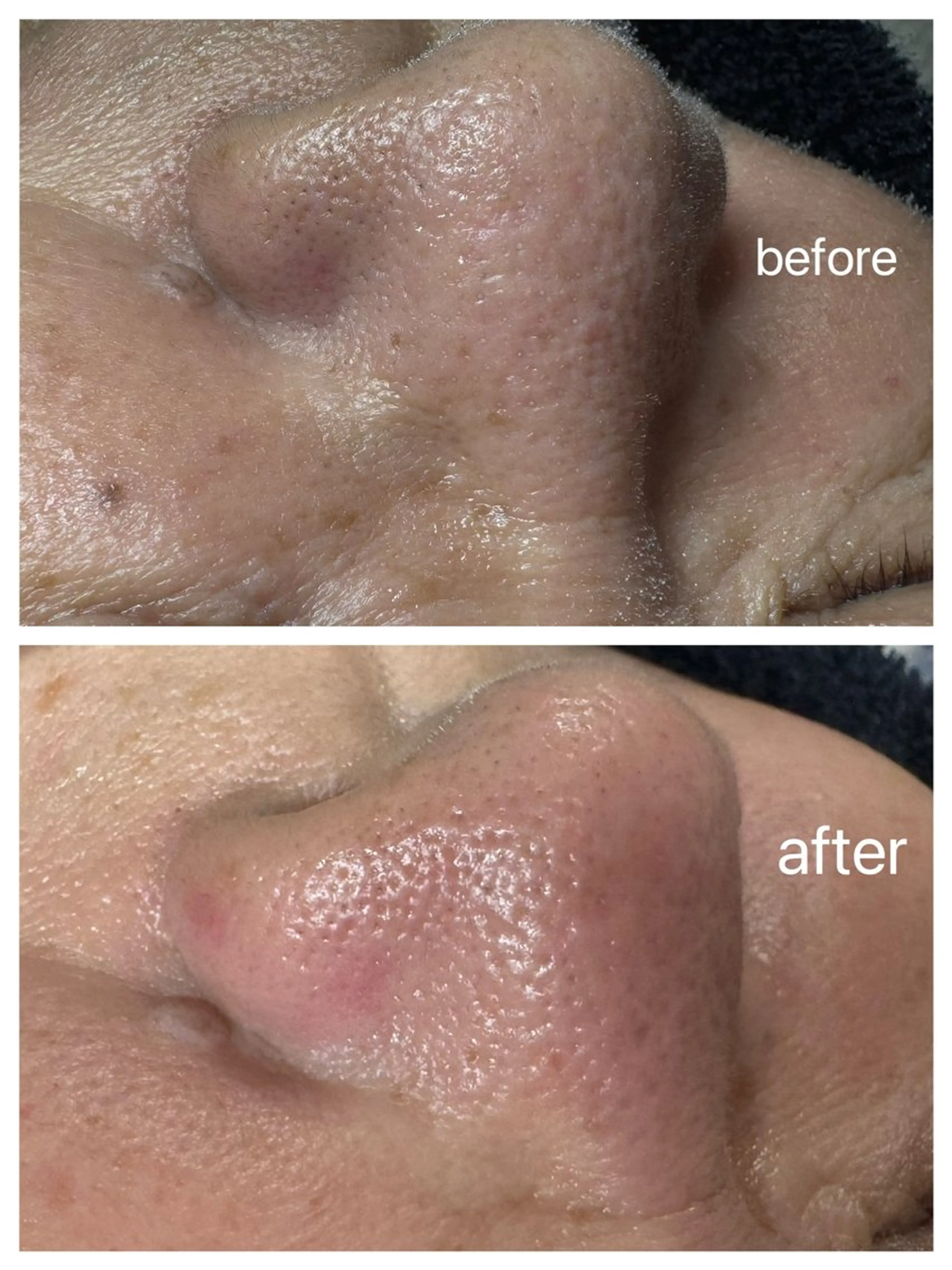 モテ眉/ Nanami🤍ྀིの眉毛・アイブロウイメージ