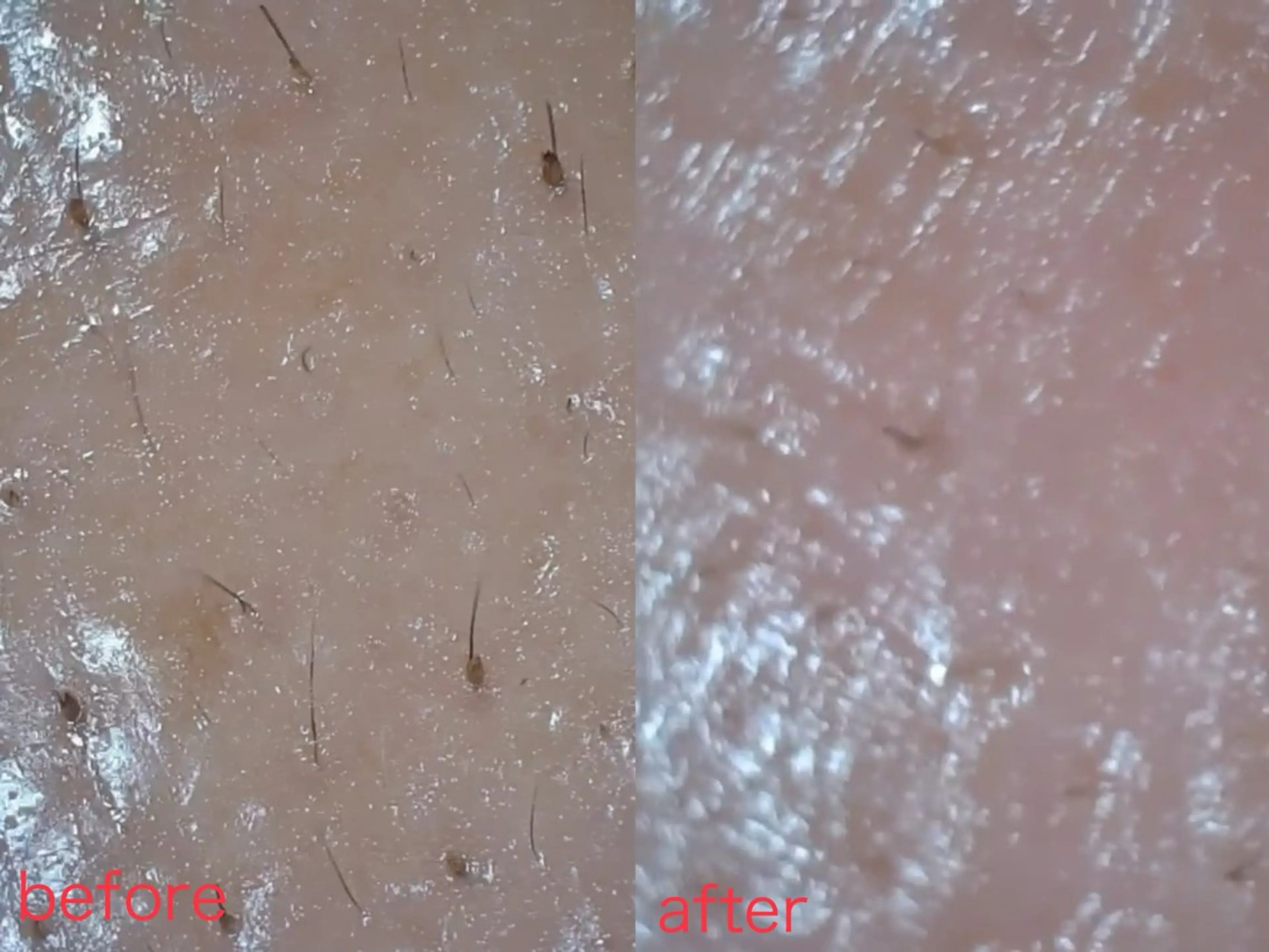 Nature Souce毛穴専門店のその他イメージ