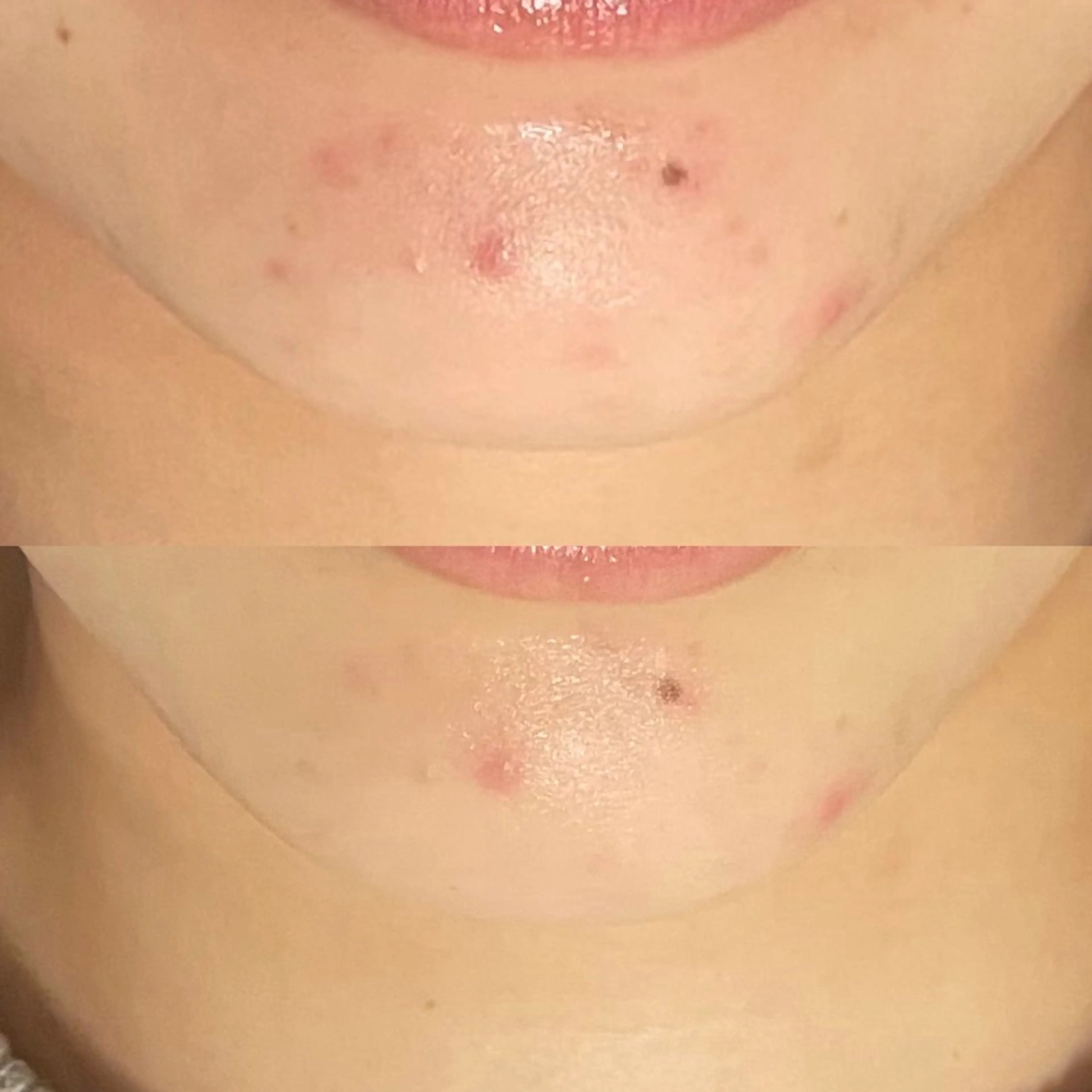 エステ フェイシャル専門店 regalo所属・フェイシャル専門店 regaloのエステ・リラクイメージ