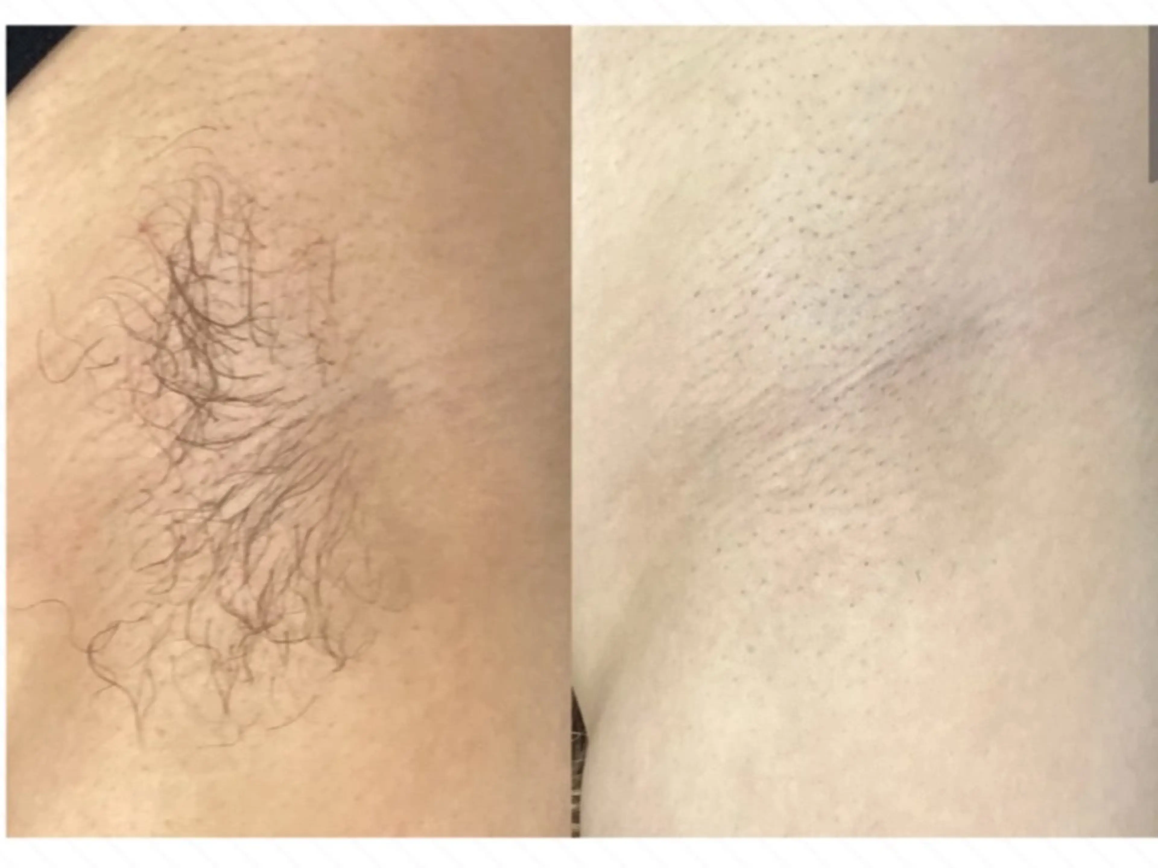 脱毛専門減毛サロン LULU.tokyoのエステ・リラクイメージ