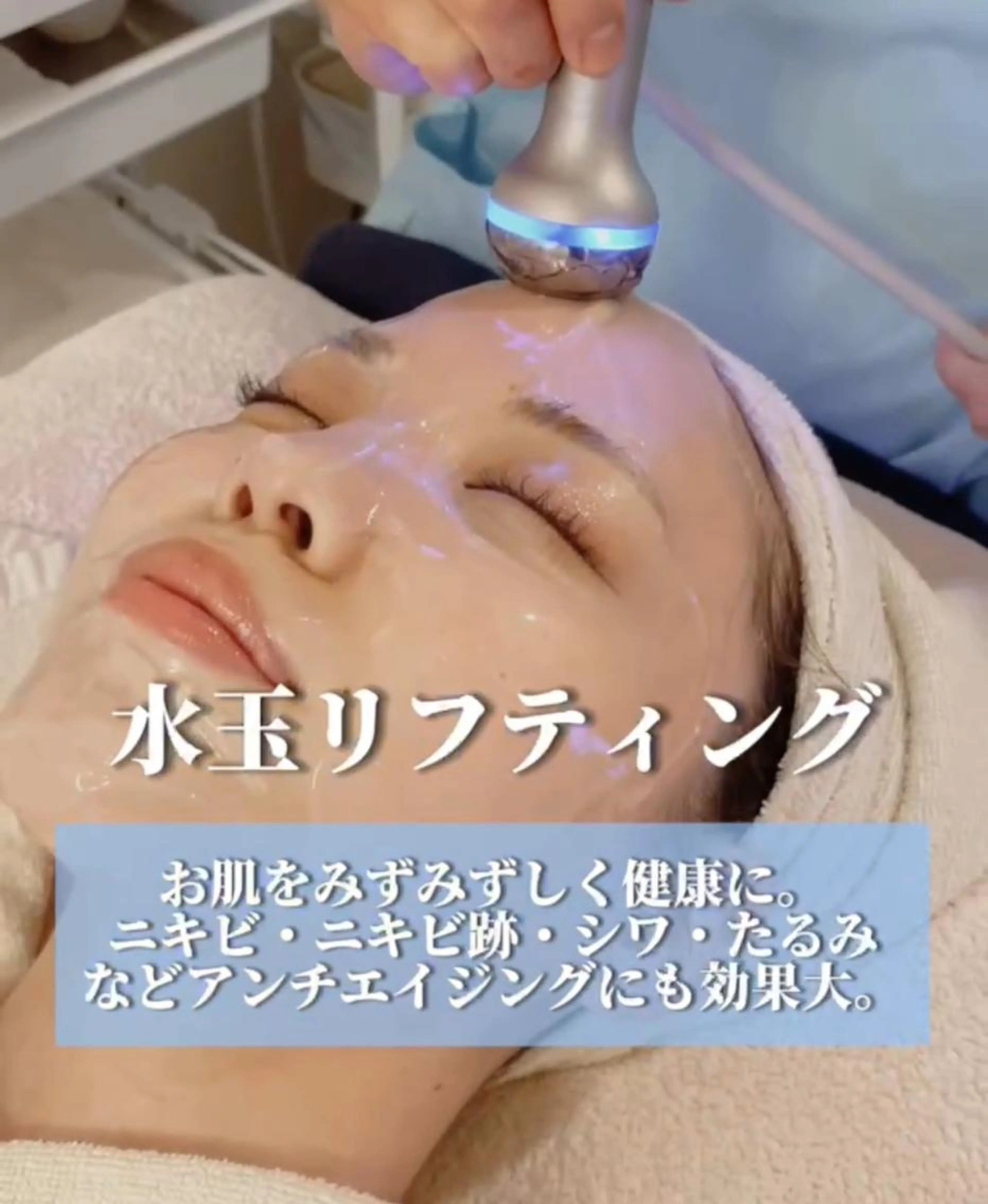 【ニキビケア】水玉リフティングLDMの写真