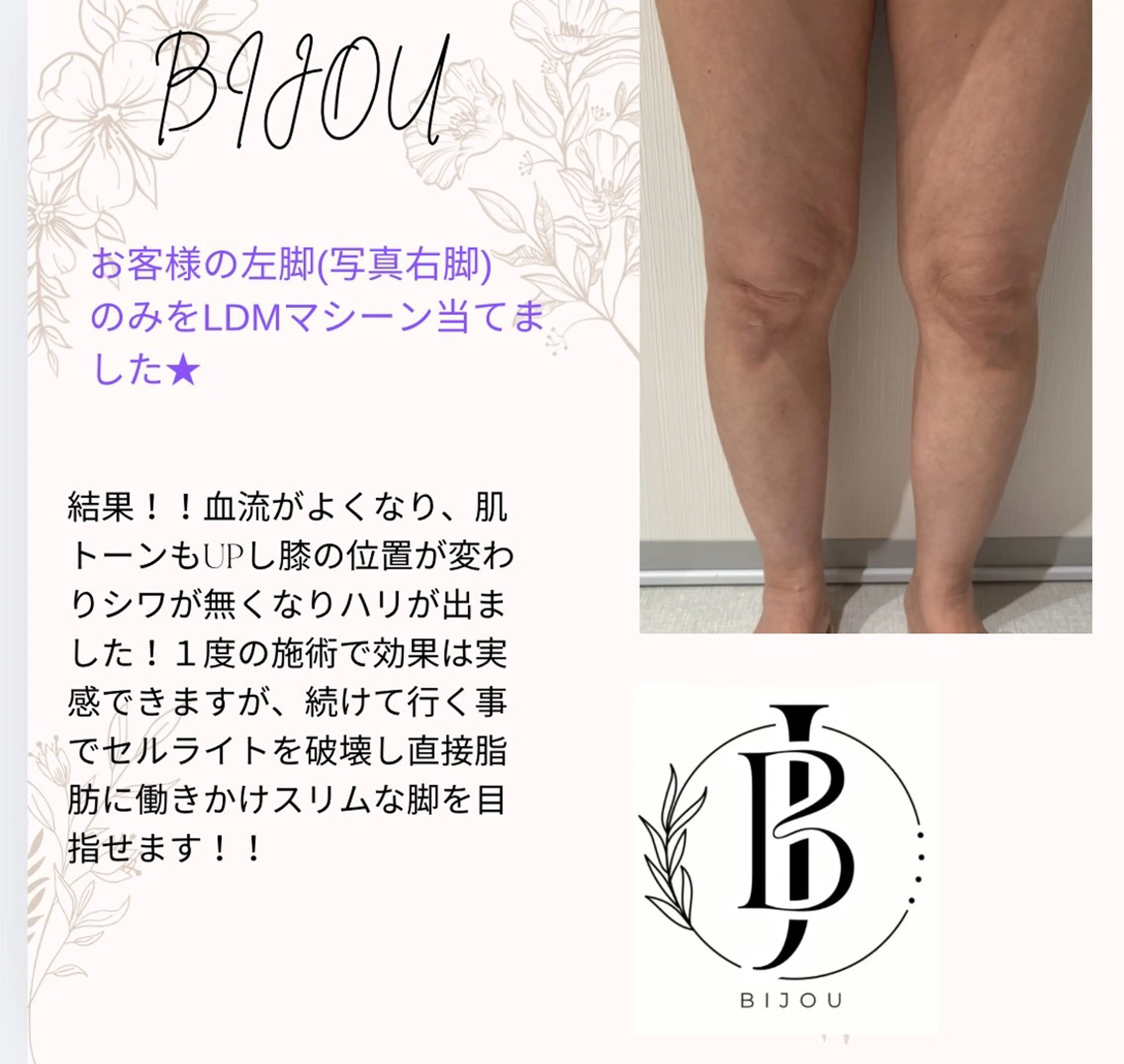 BIJOU八井 美加のエステ・リラクイメージ