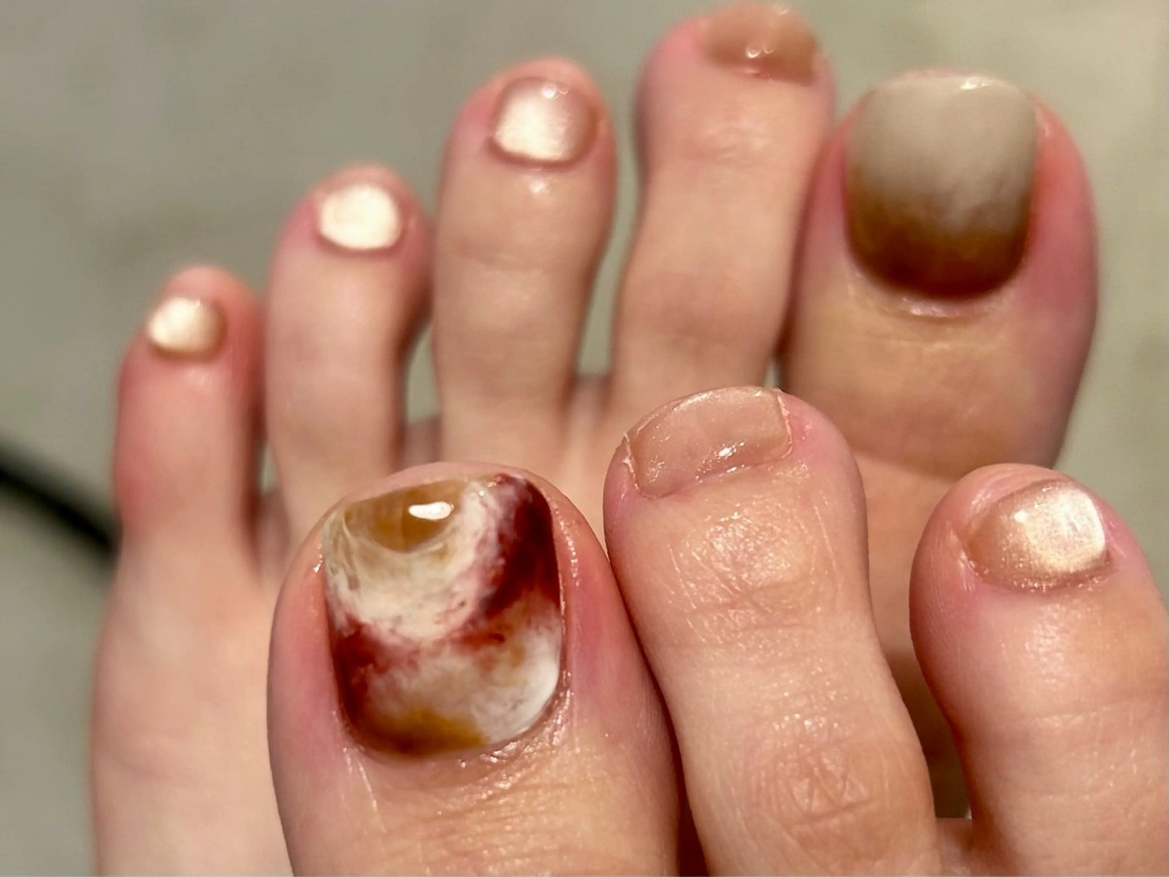 ネイル calla/中津/ パラジェルのネイルデザイン