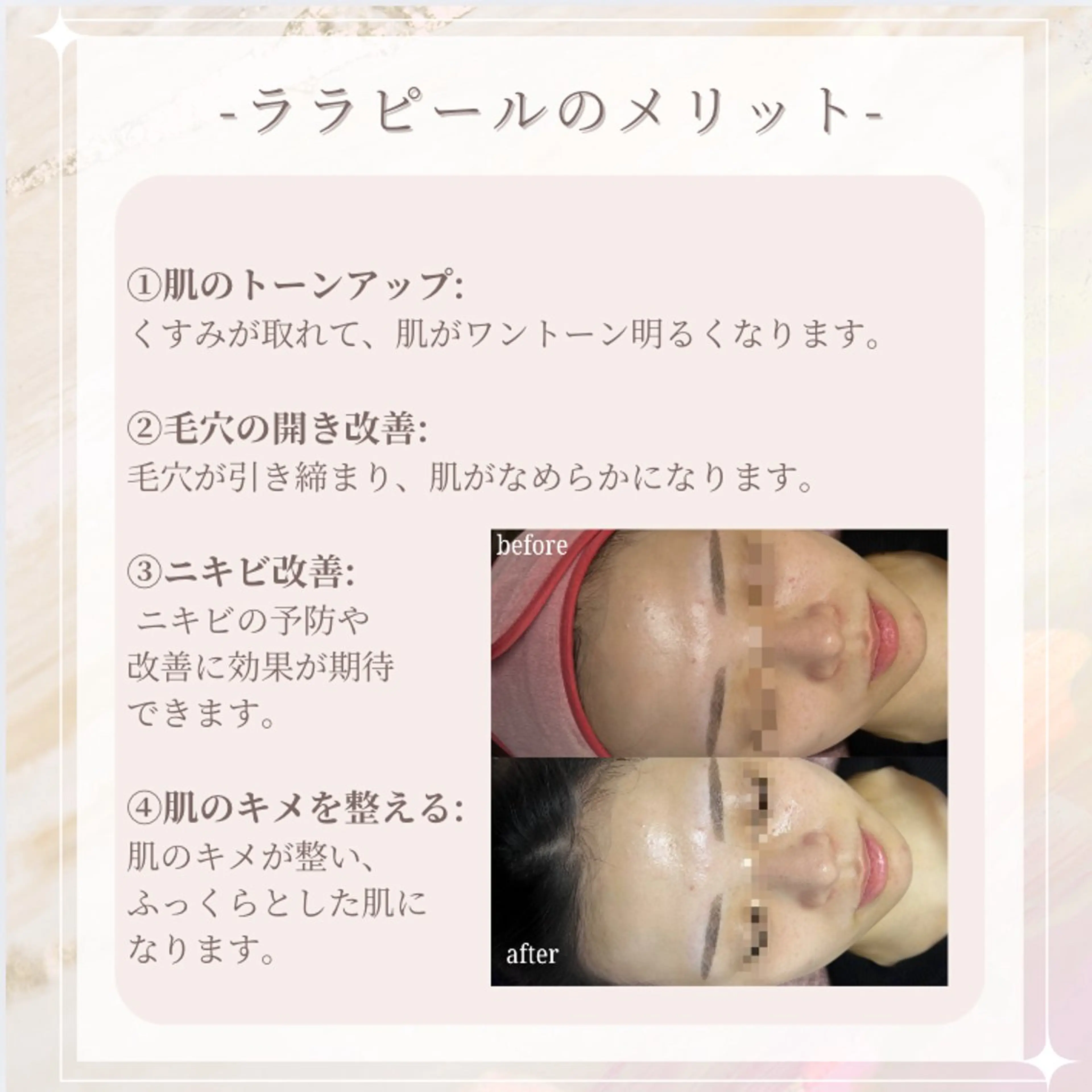エステ 🎀韓国式肌改善🎀 Miku🇰🇷💎のエステ・リラクイメージ