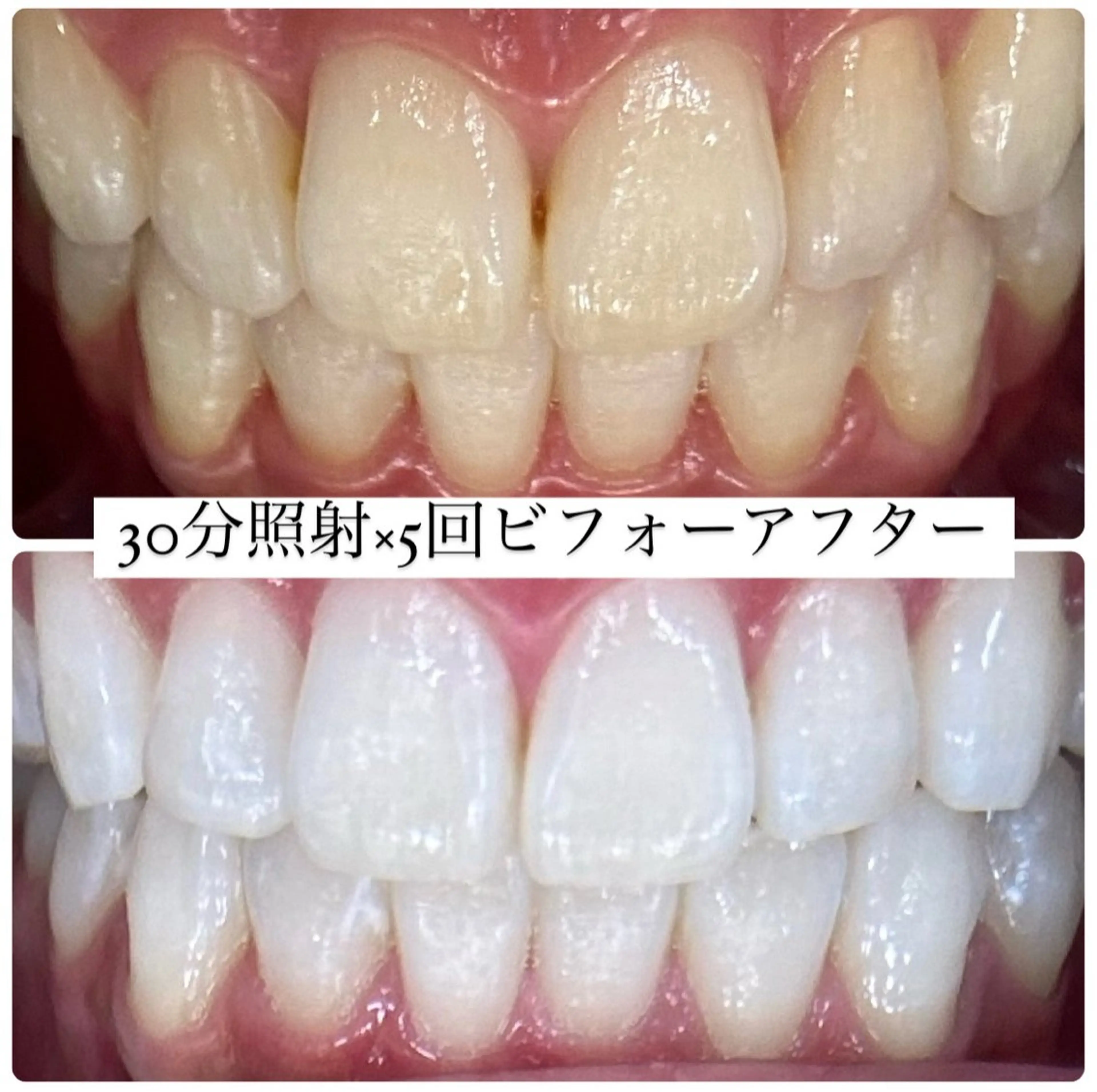 ホワイトニングルーム 横浜店のその他イメージ