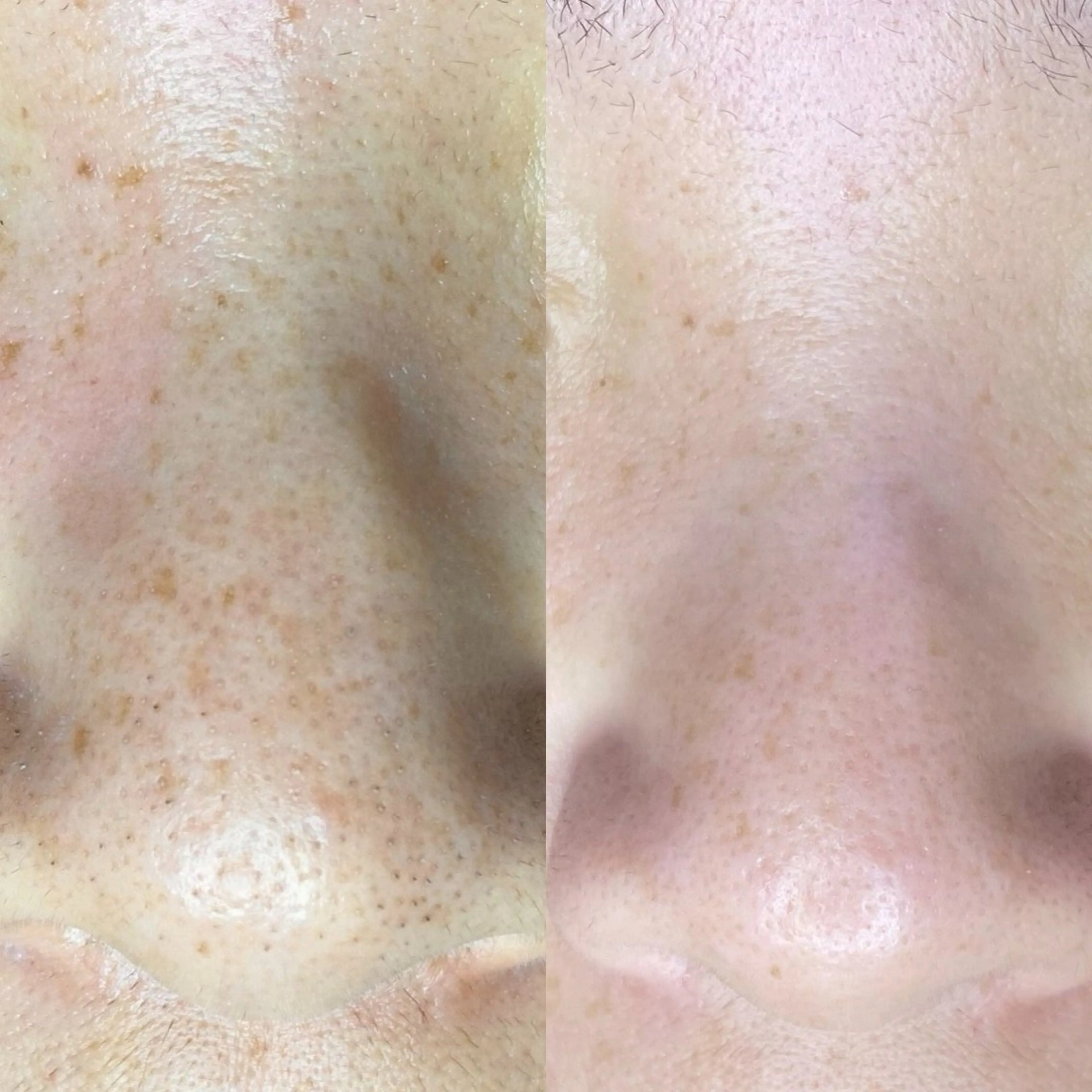 毛穴・頭皮 専門店💪のその他イメージ