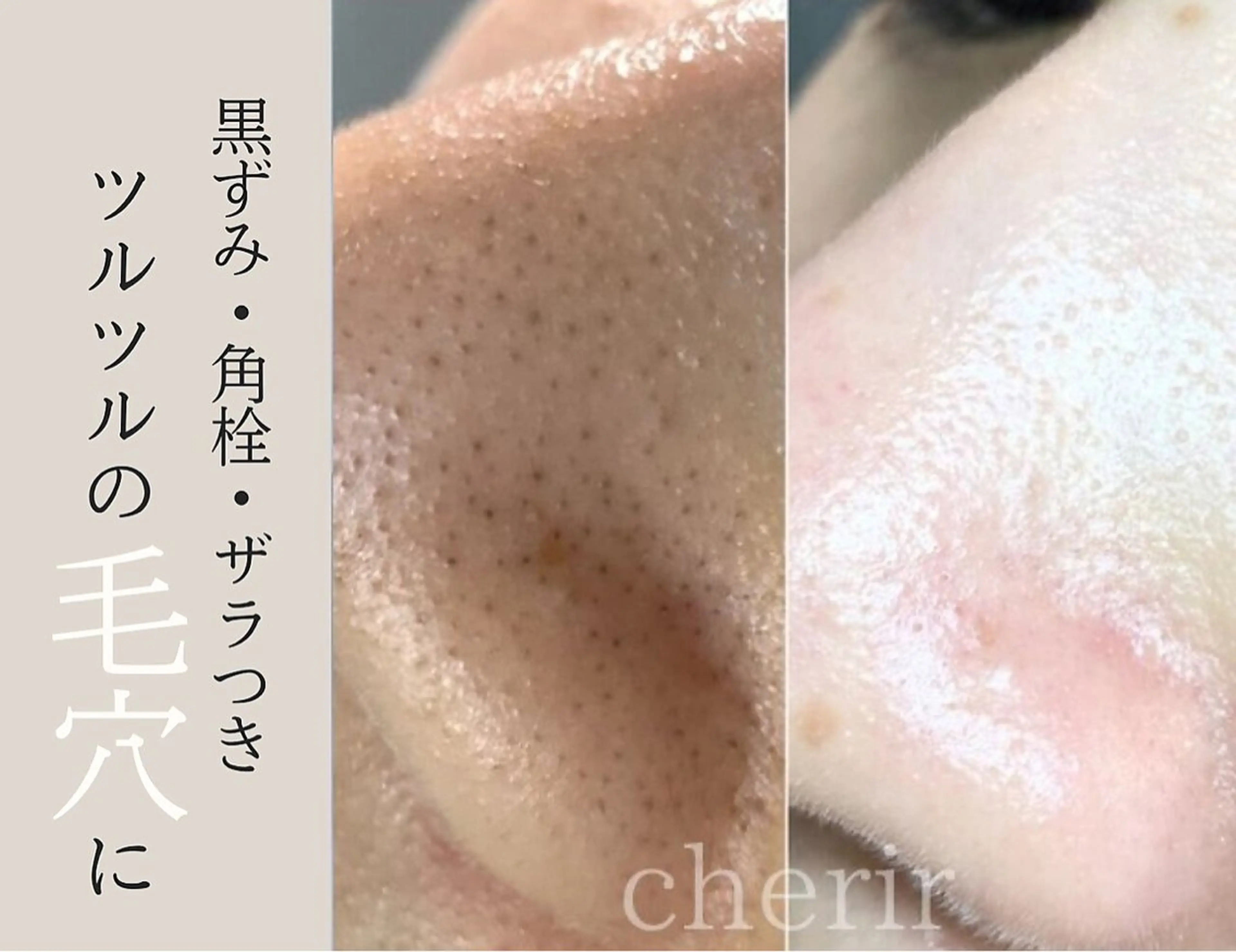 cherir所属・cherir大井町/ 毛穴ニキビ改善専門のエステ・リラクイメージ