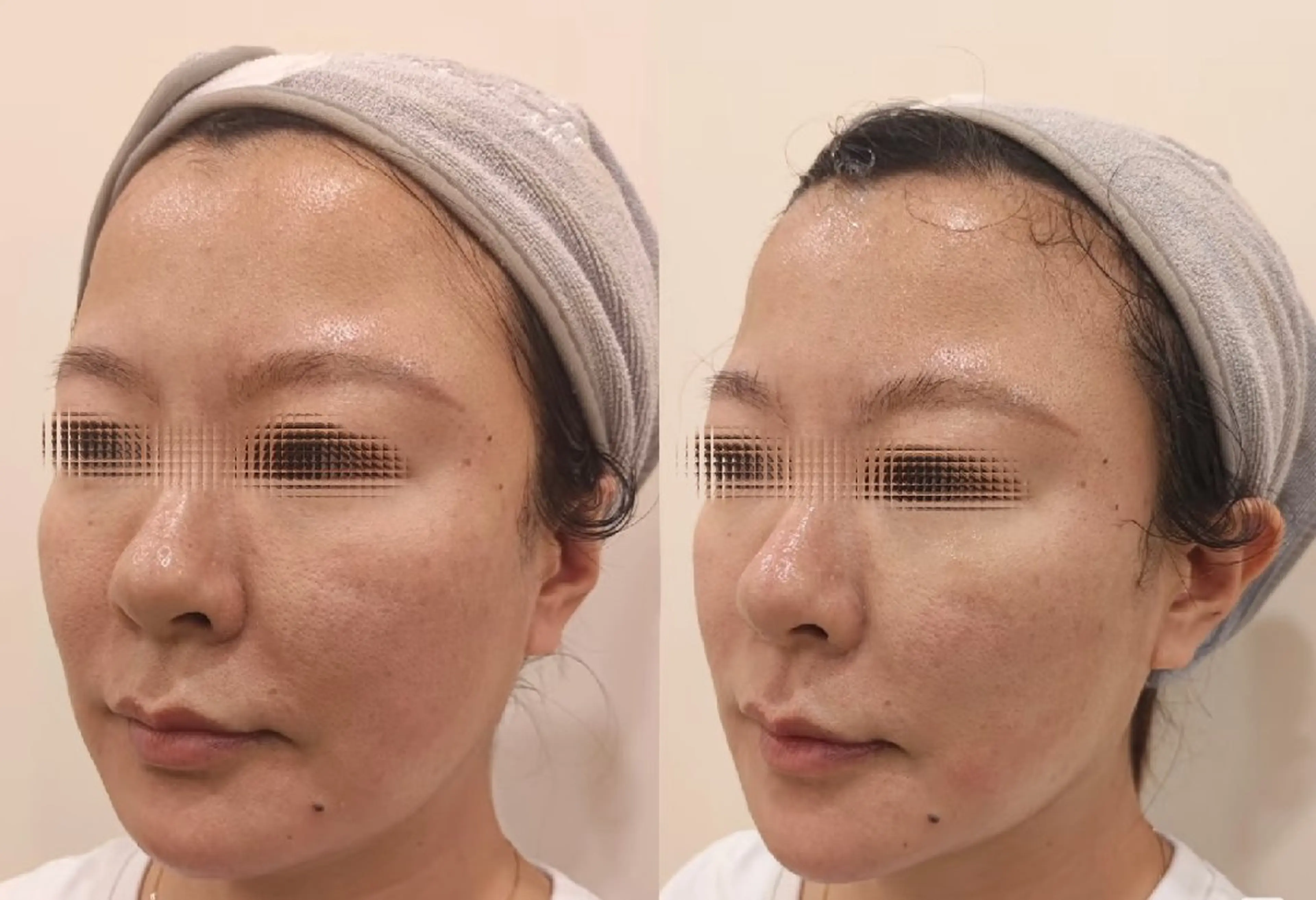 マツエク・マツパ 結婚式・ブライダル aliaハーブ水光店 エステティシャン募集のエステ・リラクイメージ