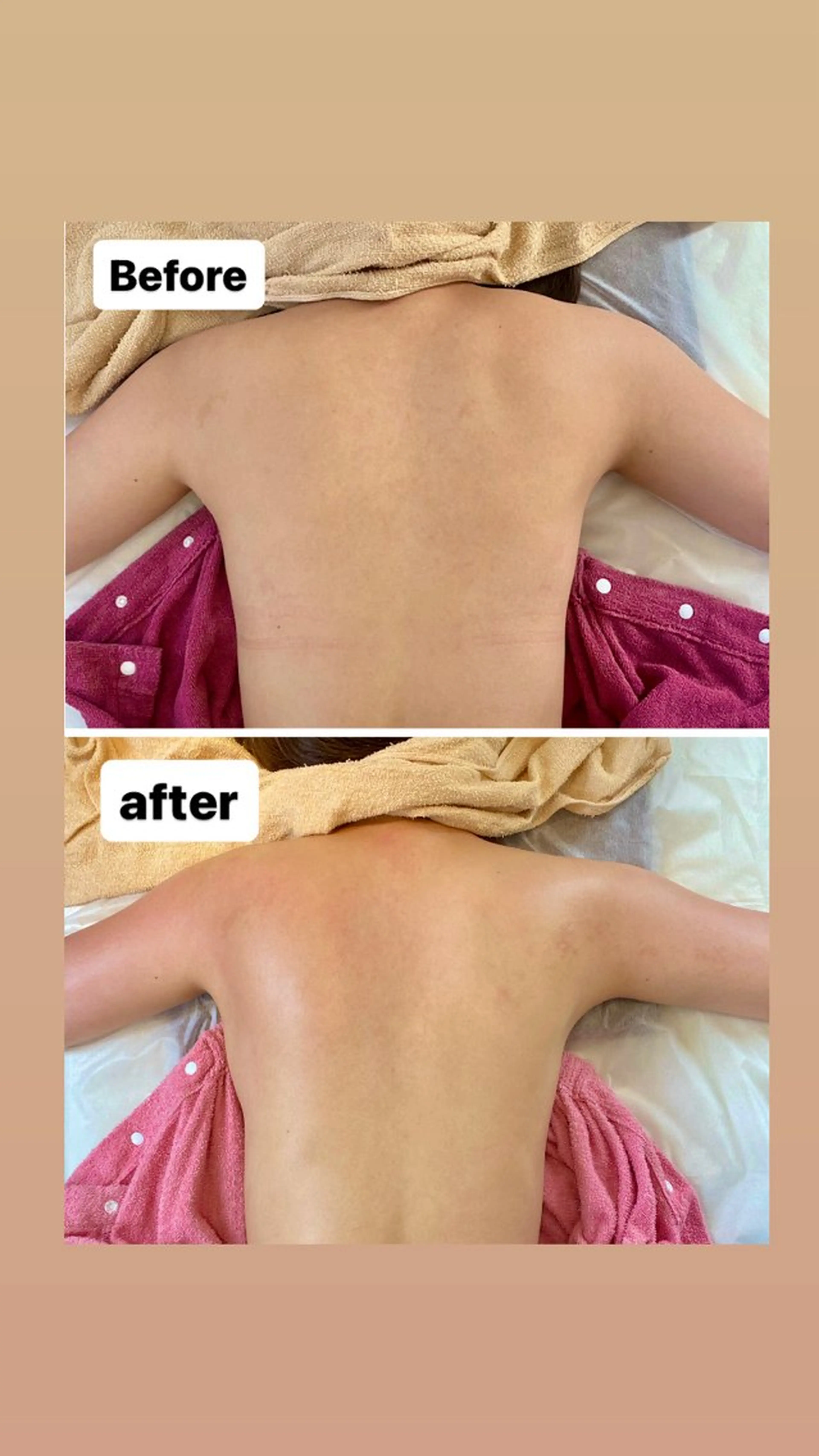 エステ リラク 脱毛・エステサロン LuLuNのエステ・リラクイメージ