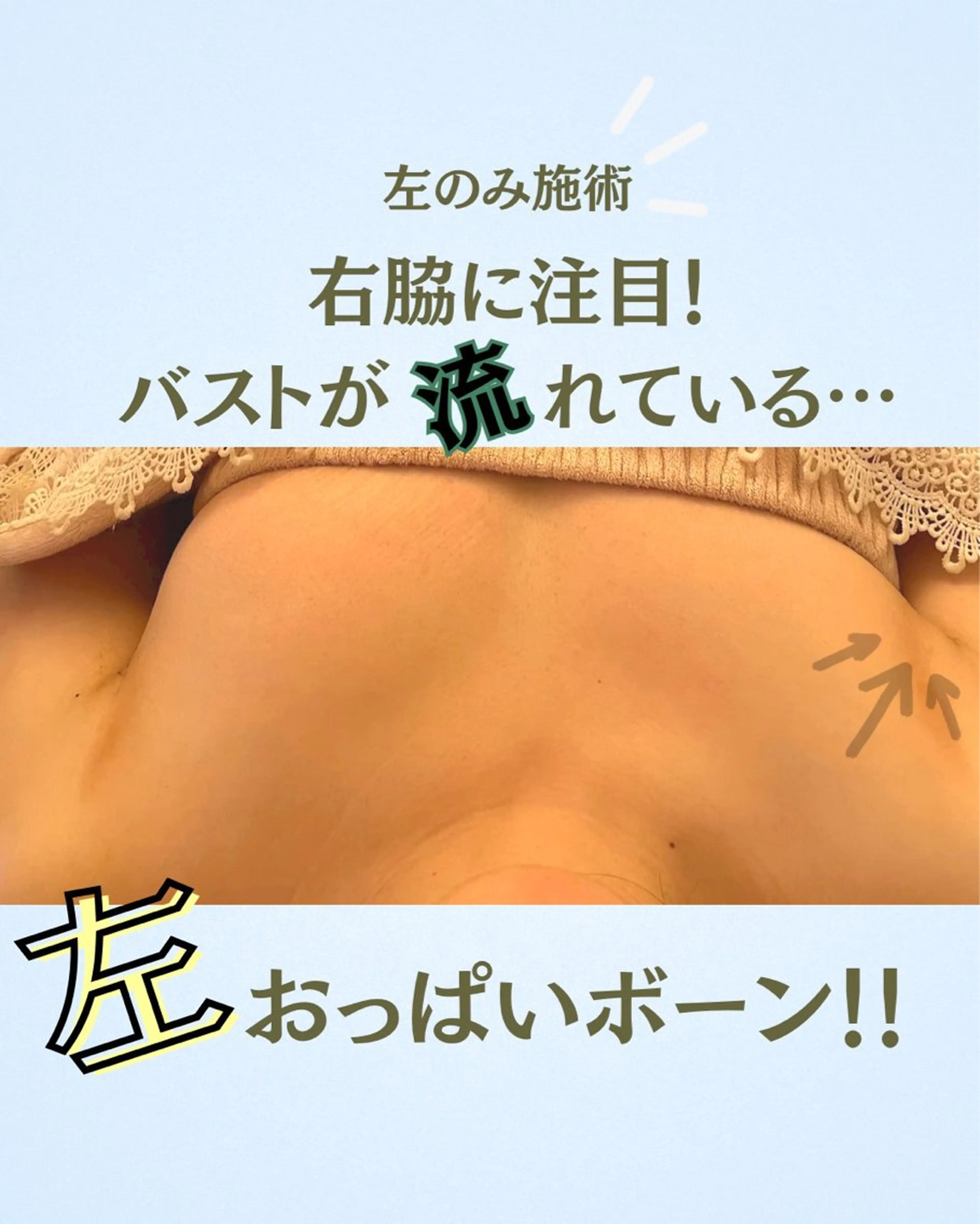 【デコルテからバスト】立体的なバストになりたい方70分の写真