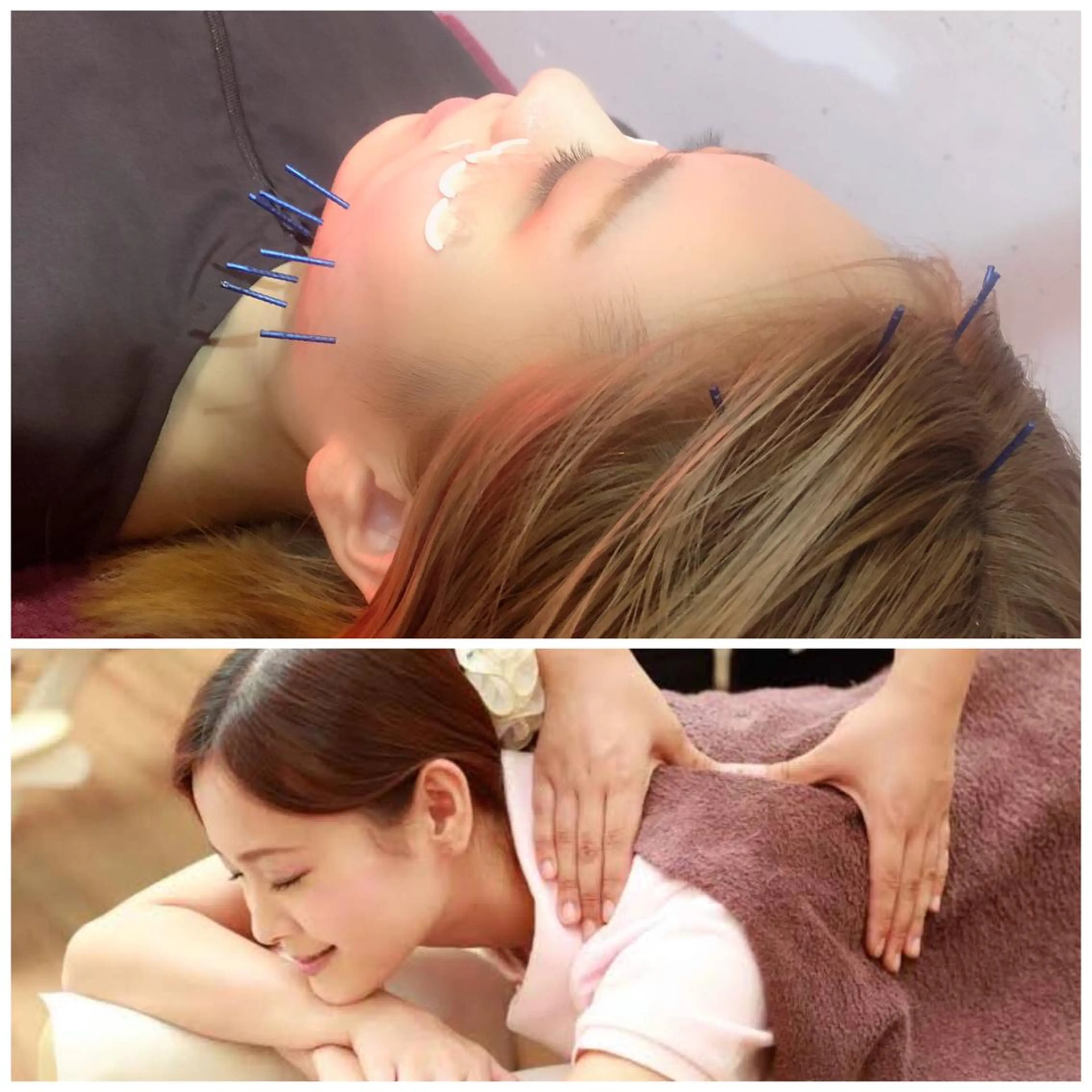 美容鍼灸女性専用 りんご鍼灸治療院のその他イメージ