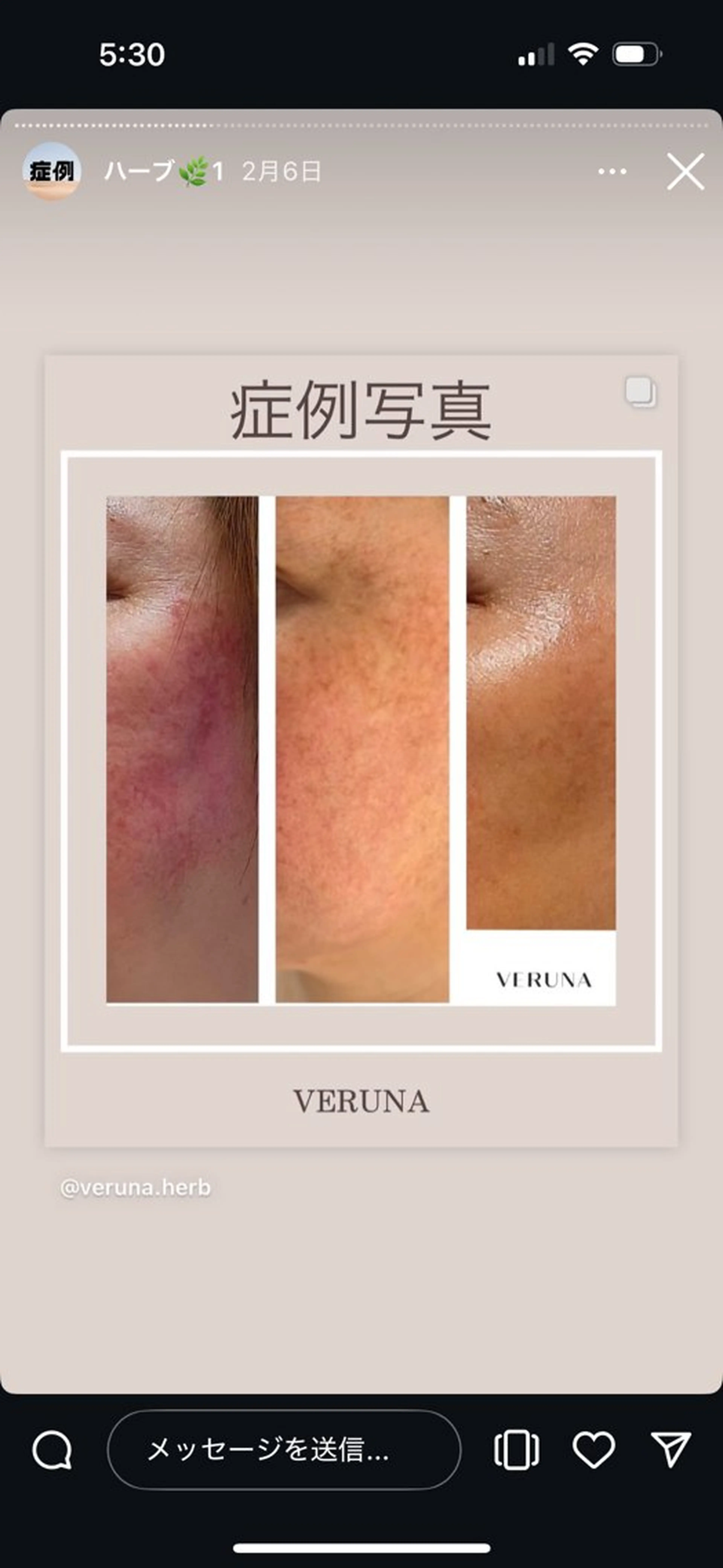 エステ ハーブピーリング専門 グランディール　武内のエステ・リラクイメージ