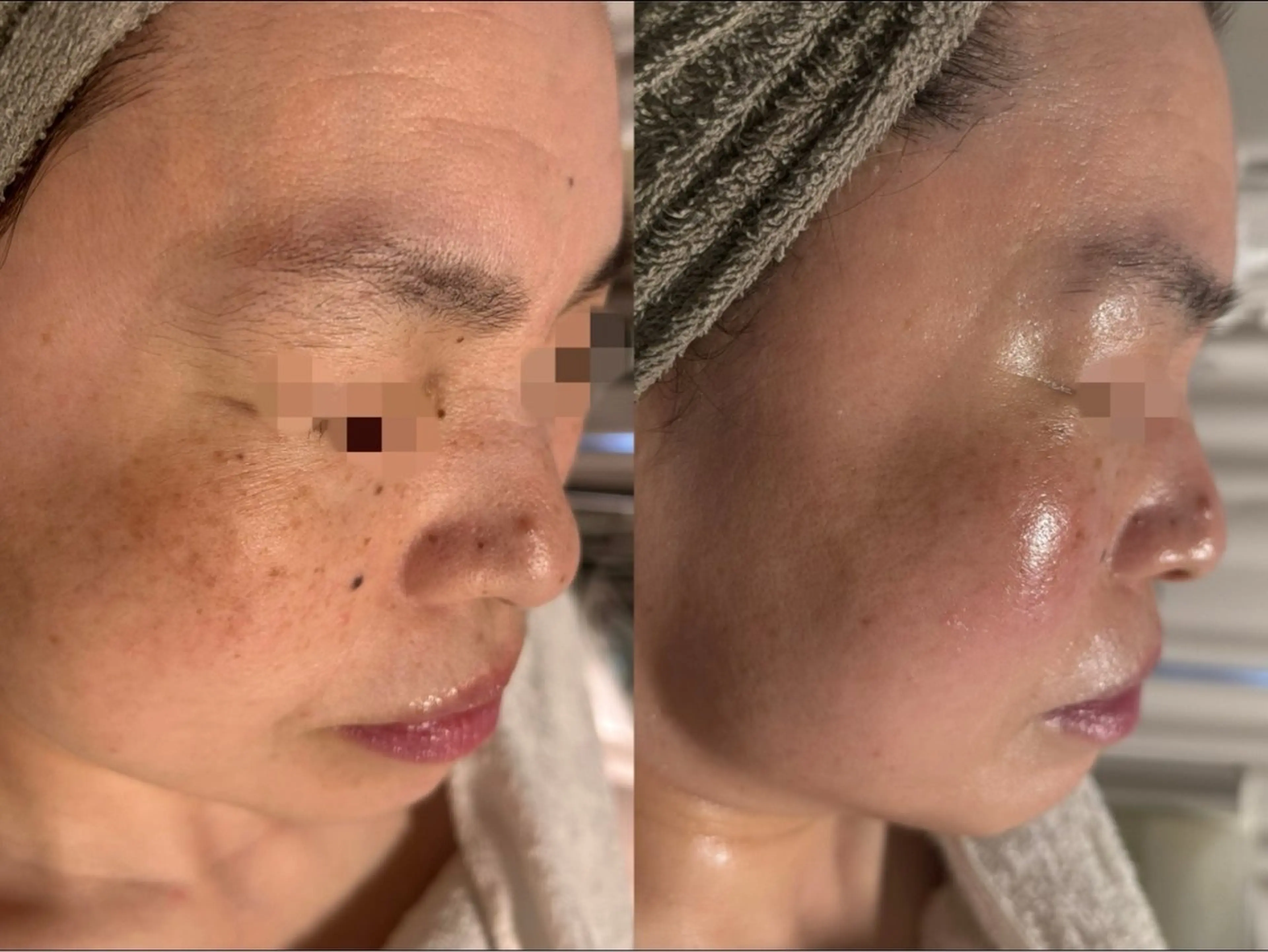 エステ リラク lumirise所属・lumi riseのエステ・リラクイメージ