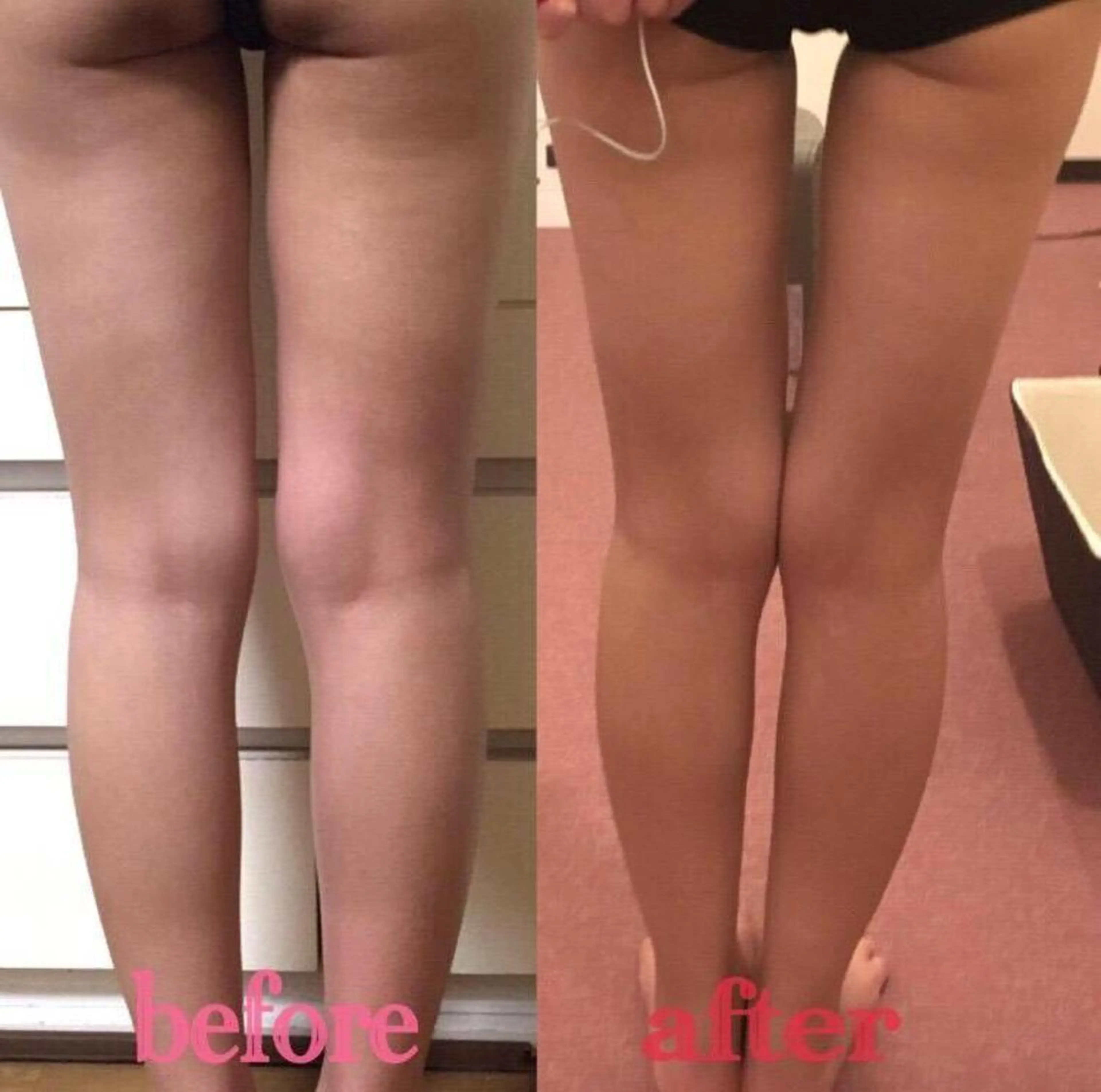 HappIness 遠赤外線ドームのエステ・リラクイメージ