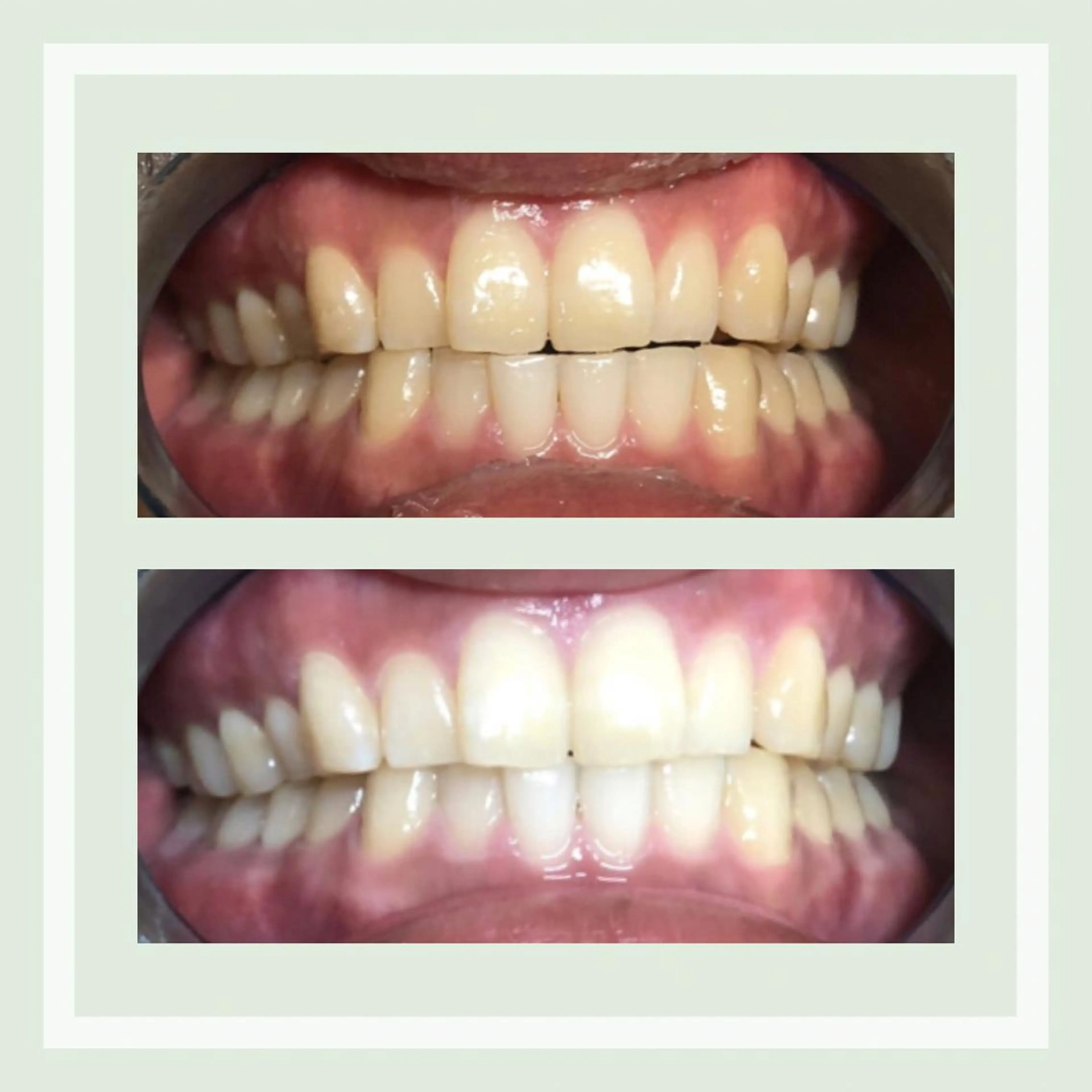 韓国式3D毛穴洗浄 lonhanaのその他イメージ