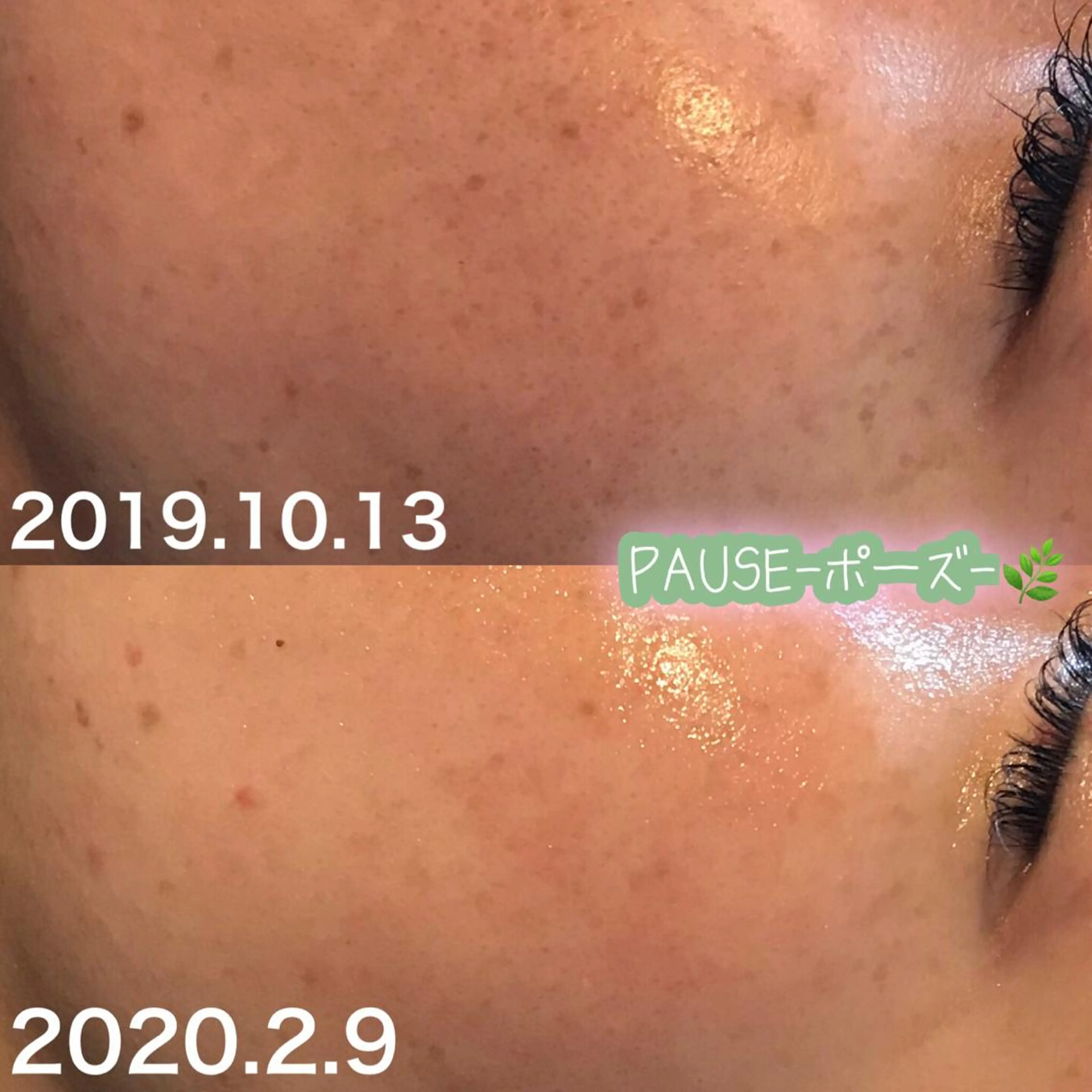 エステ 浜野 恵美のエステ・リラクイメージ