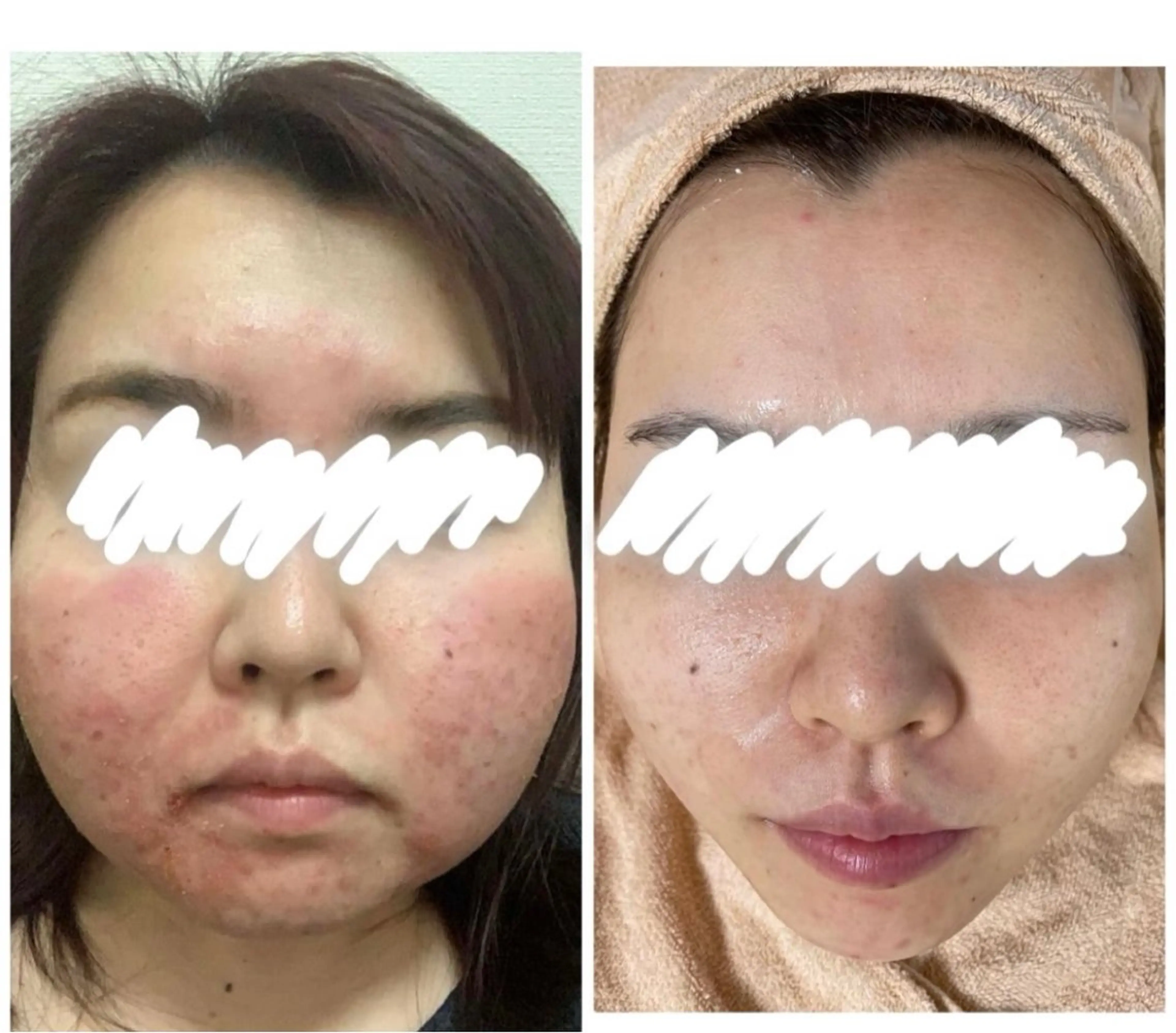 都度払い肌改善専門店 店長二上文香のエステ・リラクイメージ