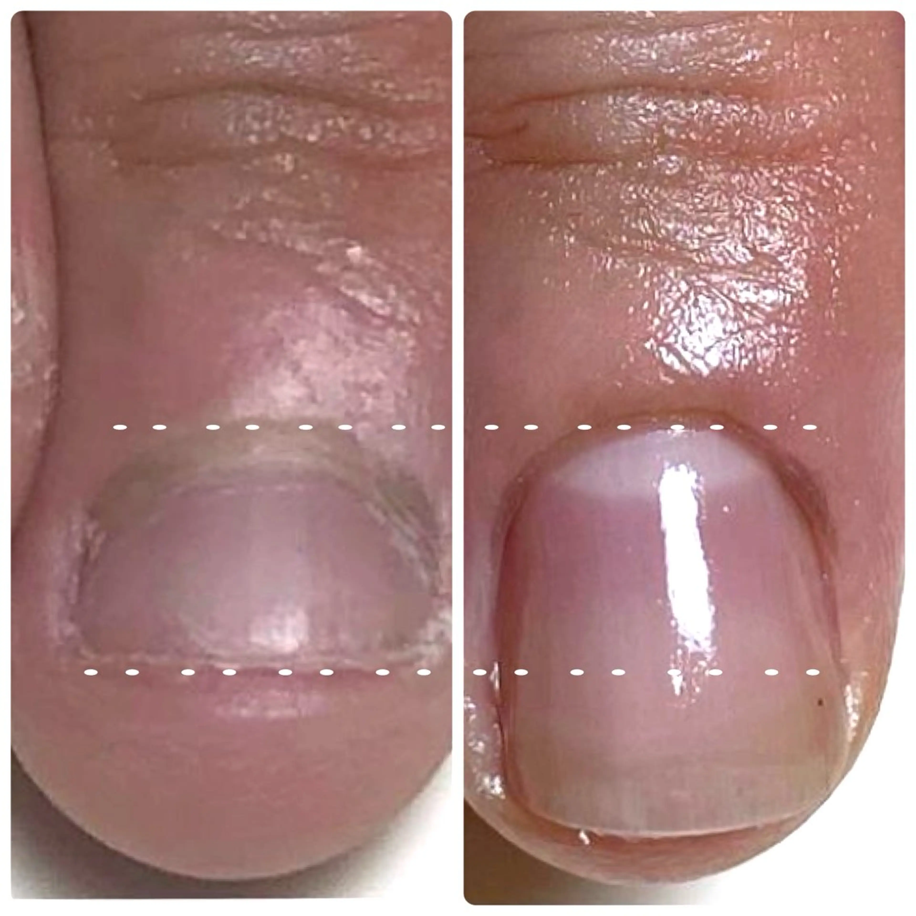 Nail ビ爪のネイルデザイン