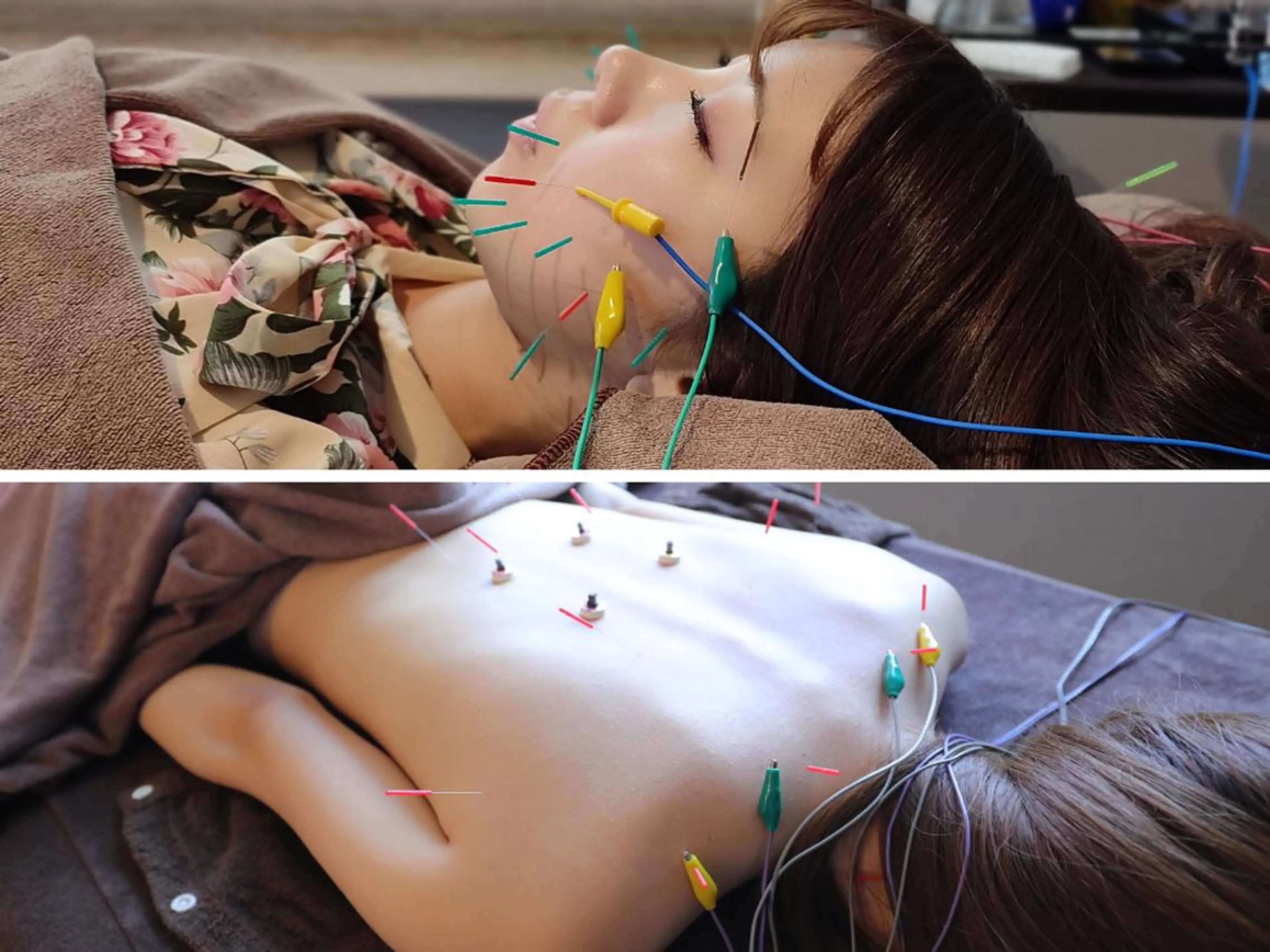 エステ リラク 美容とカラダの鍼灸 サロン やなけんのエステ・リラクイメージ