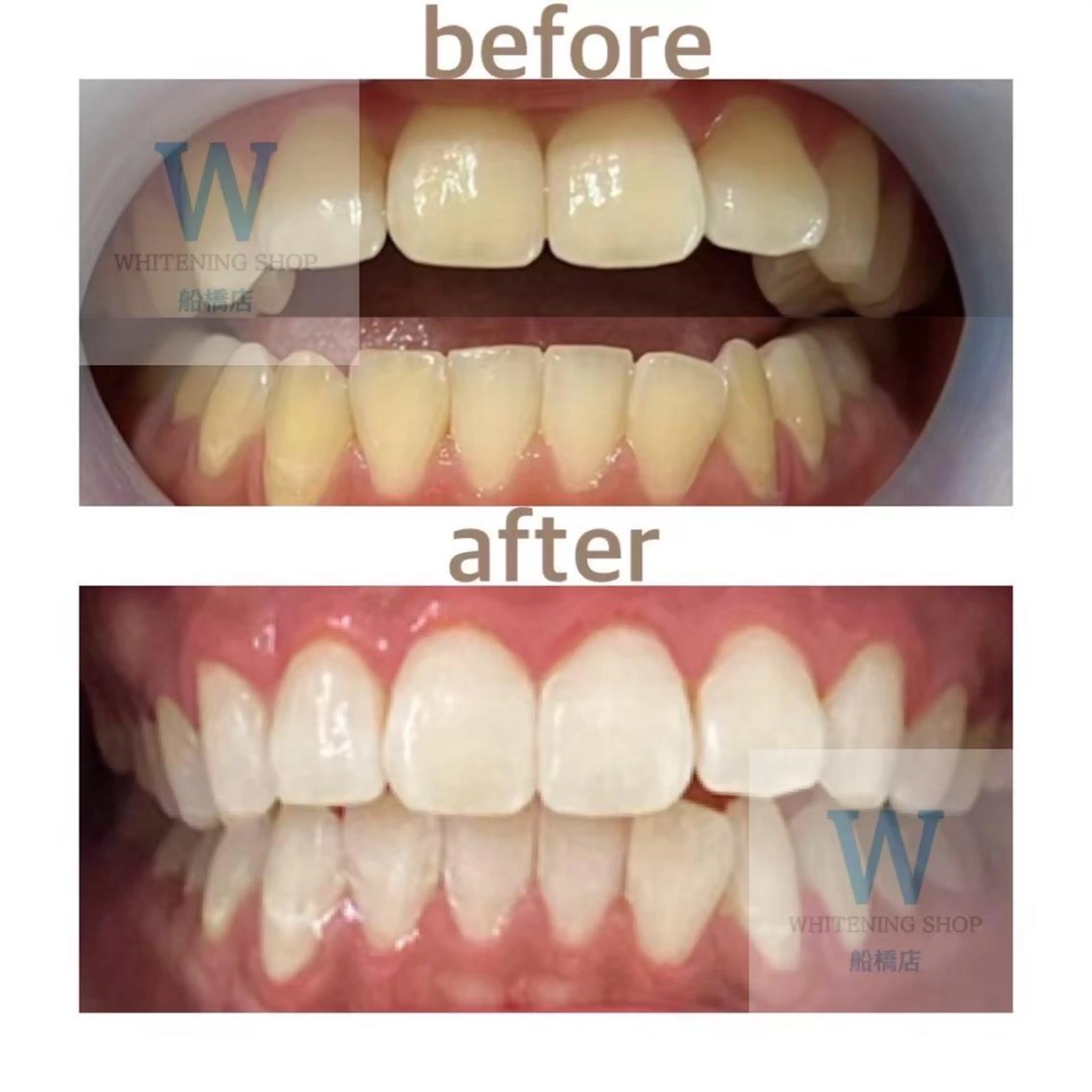 ホワイトニング ショップ船橋店🦷のエステ・リラクイメージ