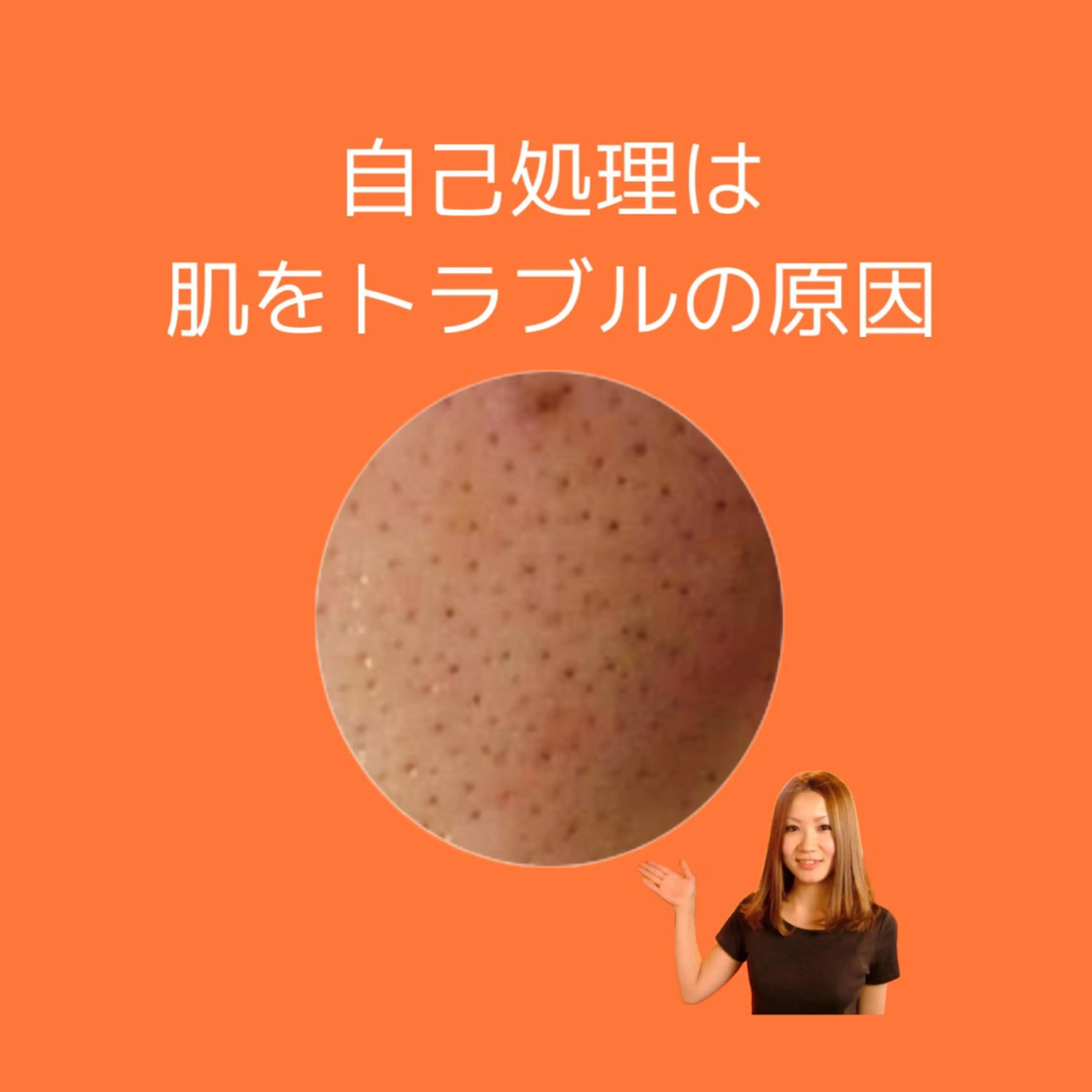 脱毛 エステ脱毛サロン Otti  オッティのエステ・リラクイメージ