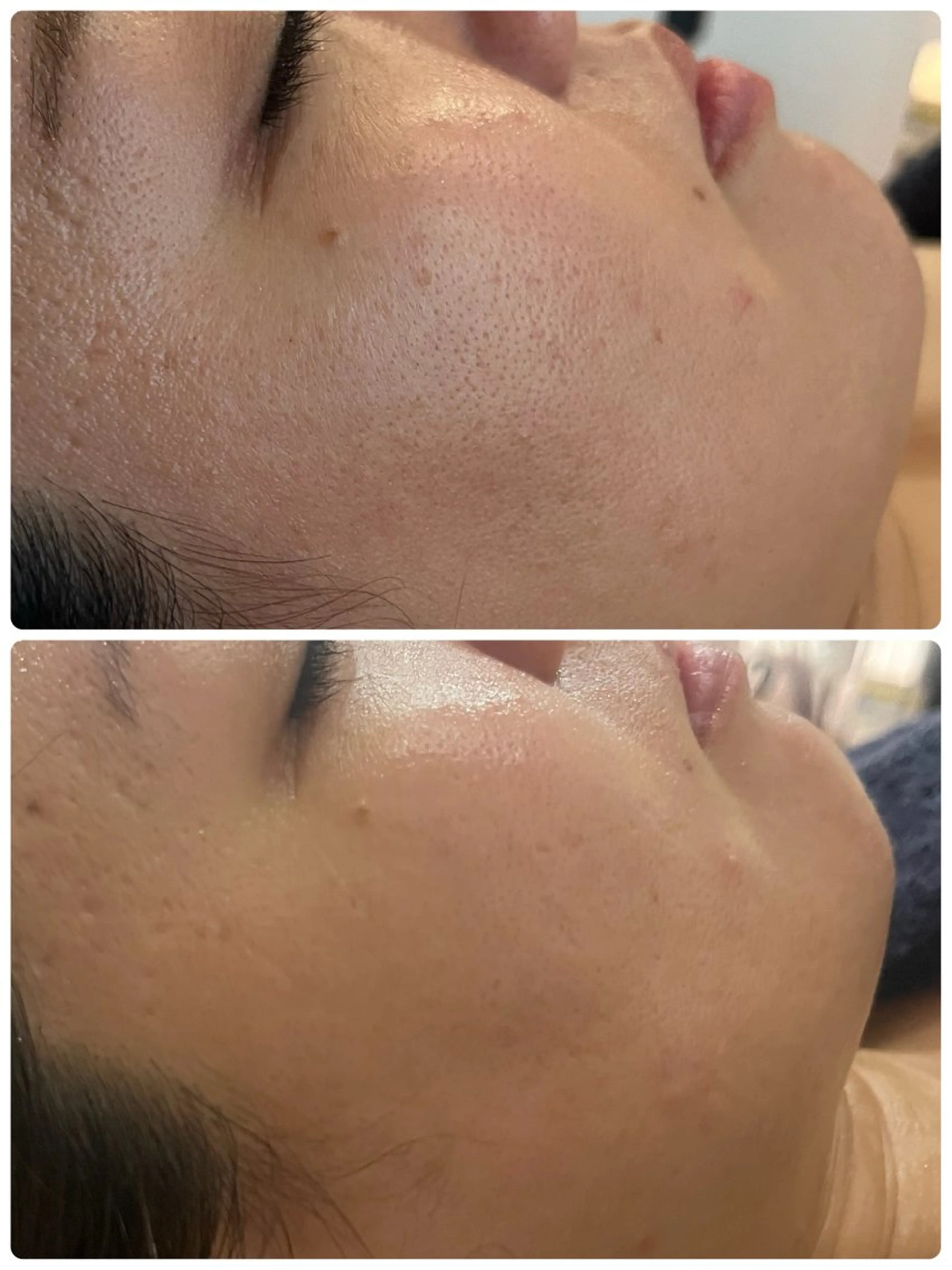 エステ メナードフェイシャルサロン　リンガーデン所属・田中 友佳理のエステ・リラクイメージ