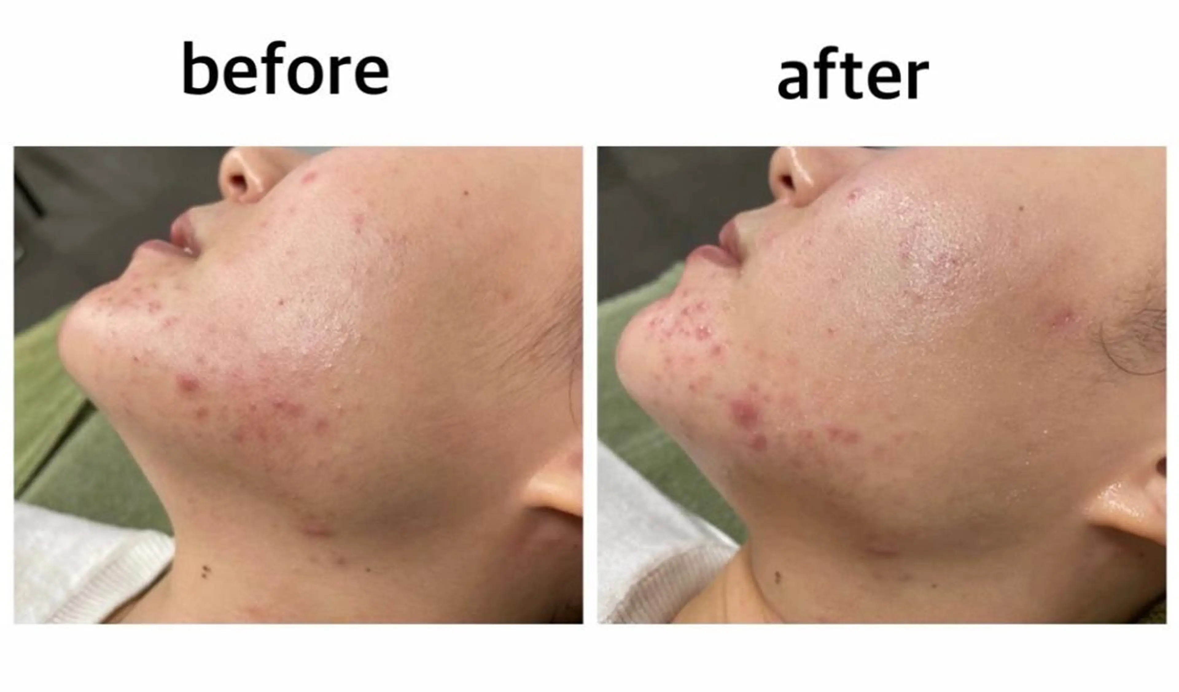 ビューティーサロン B.glossyのネイルデザイン