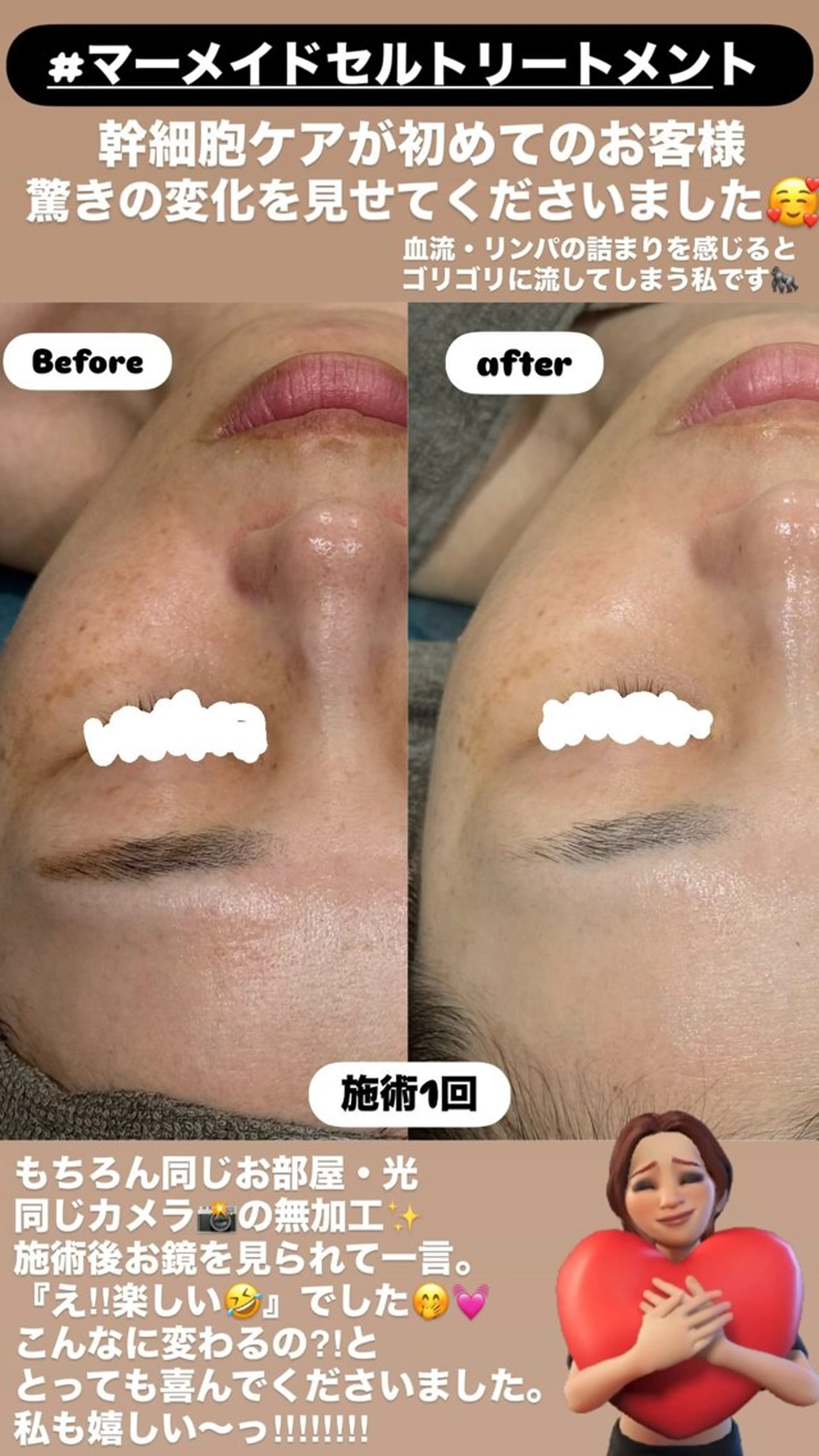 エステ LiZA エステティックサロンのエステ・リラクイメージ