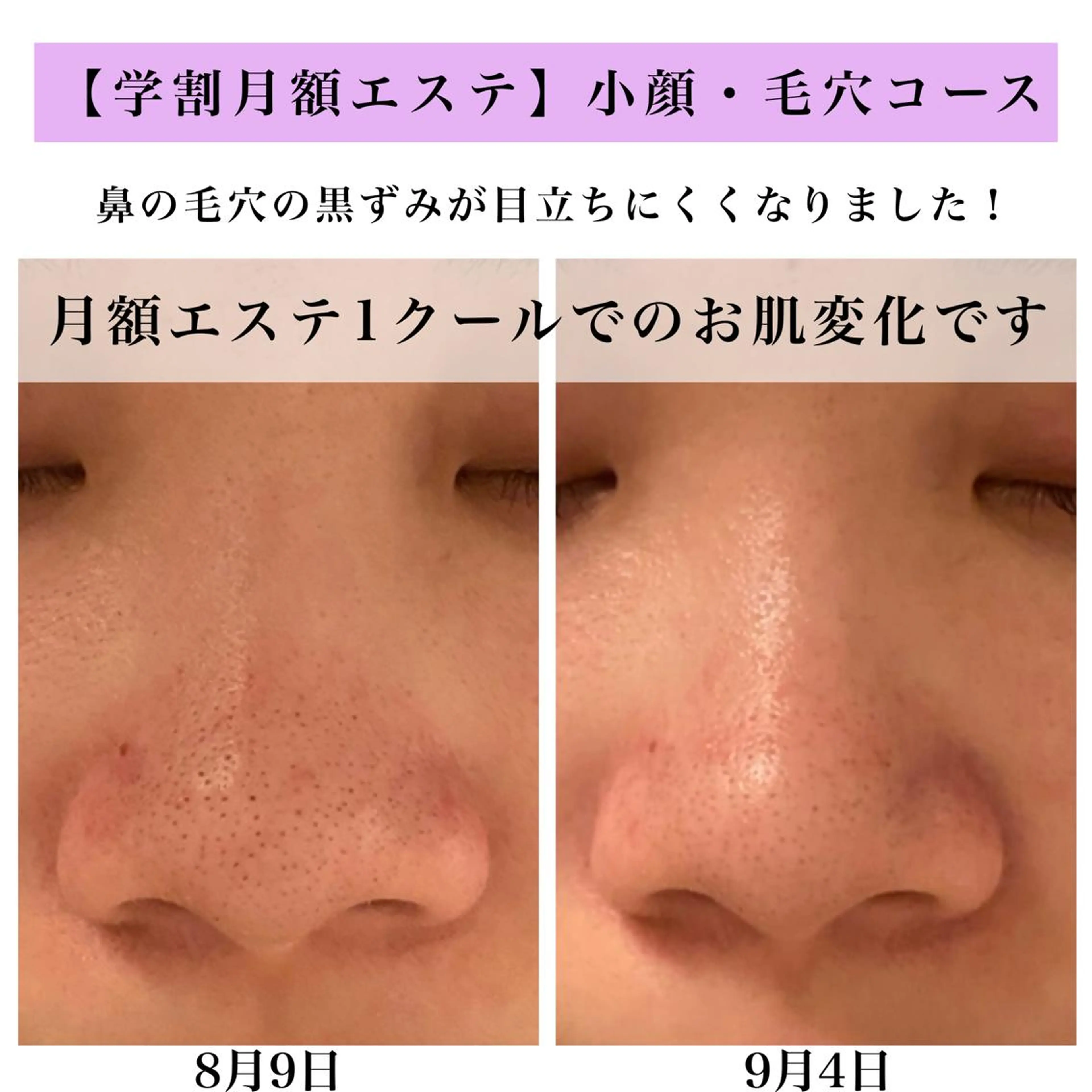 Bellesthe （ベルエステ）のエステ・リラクイメージ