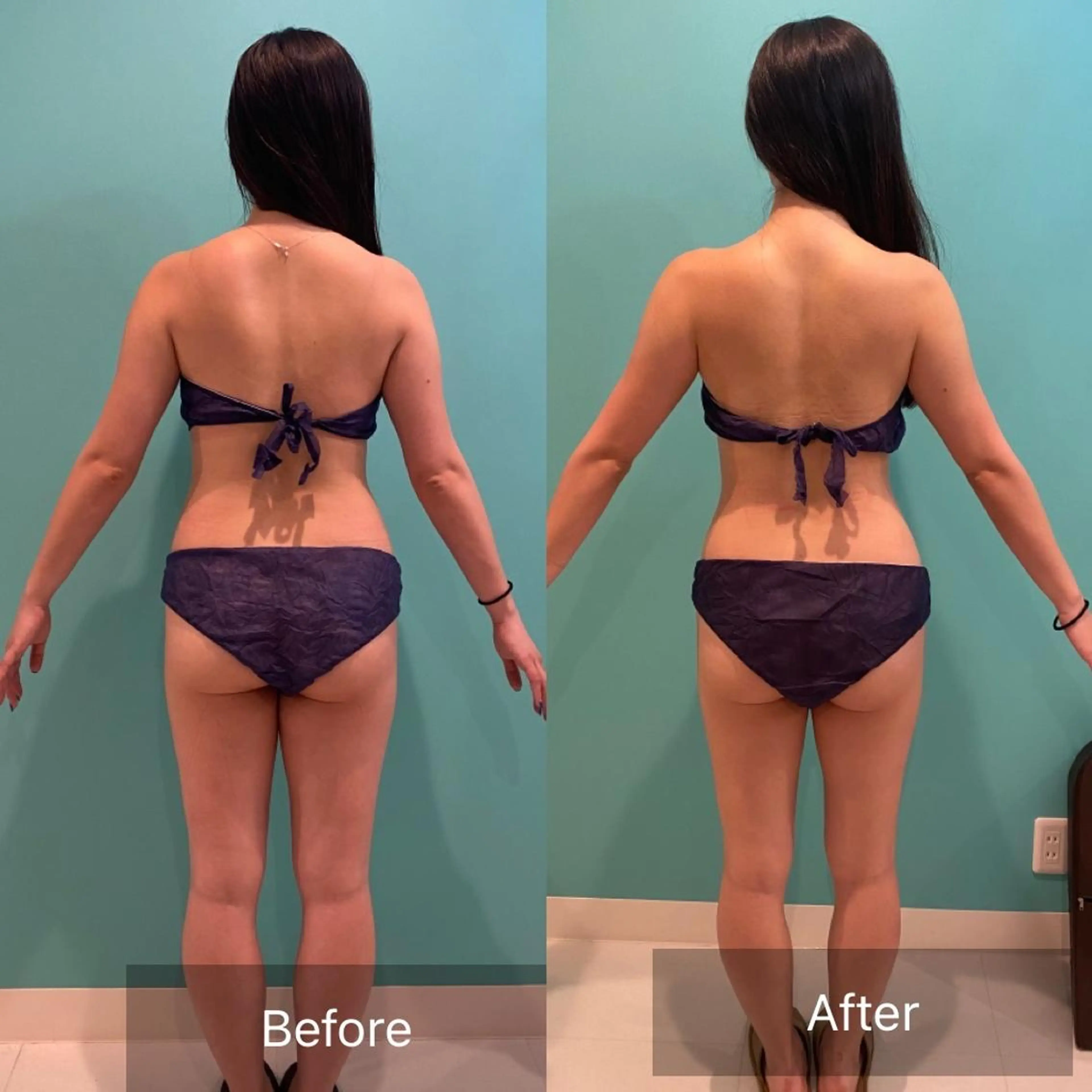 【お腹痩せ✨】くびれ＆腸活！キャビテーション＋ラジオ波＋リンパマッサージ　30分　￥4,980の写真